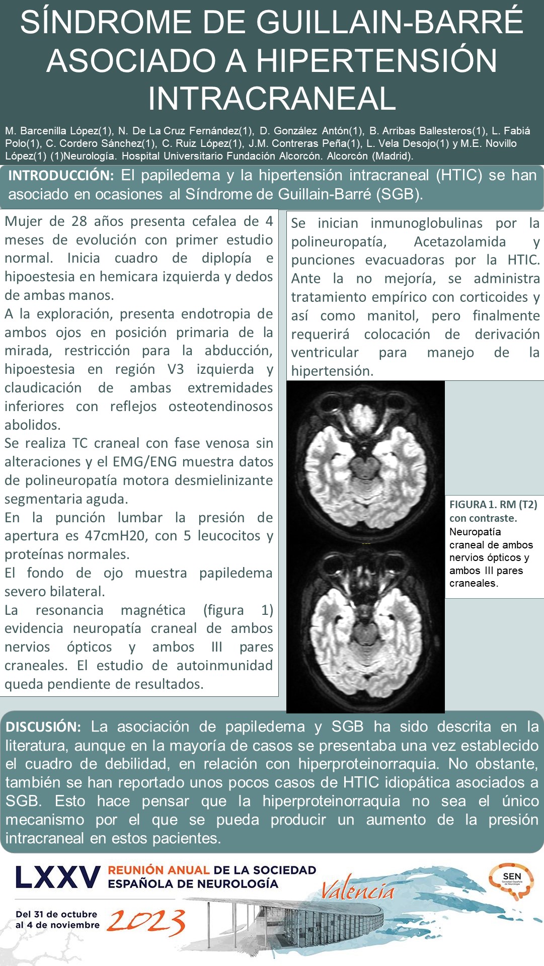 Síndrome de Guillain-Barré asociado a hipertensión intracraneal