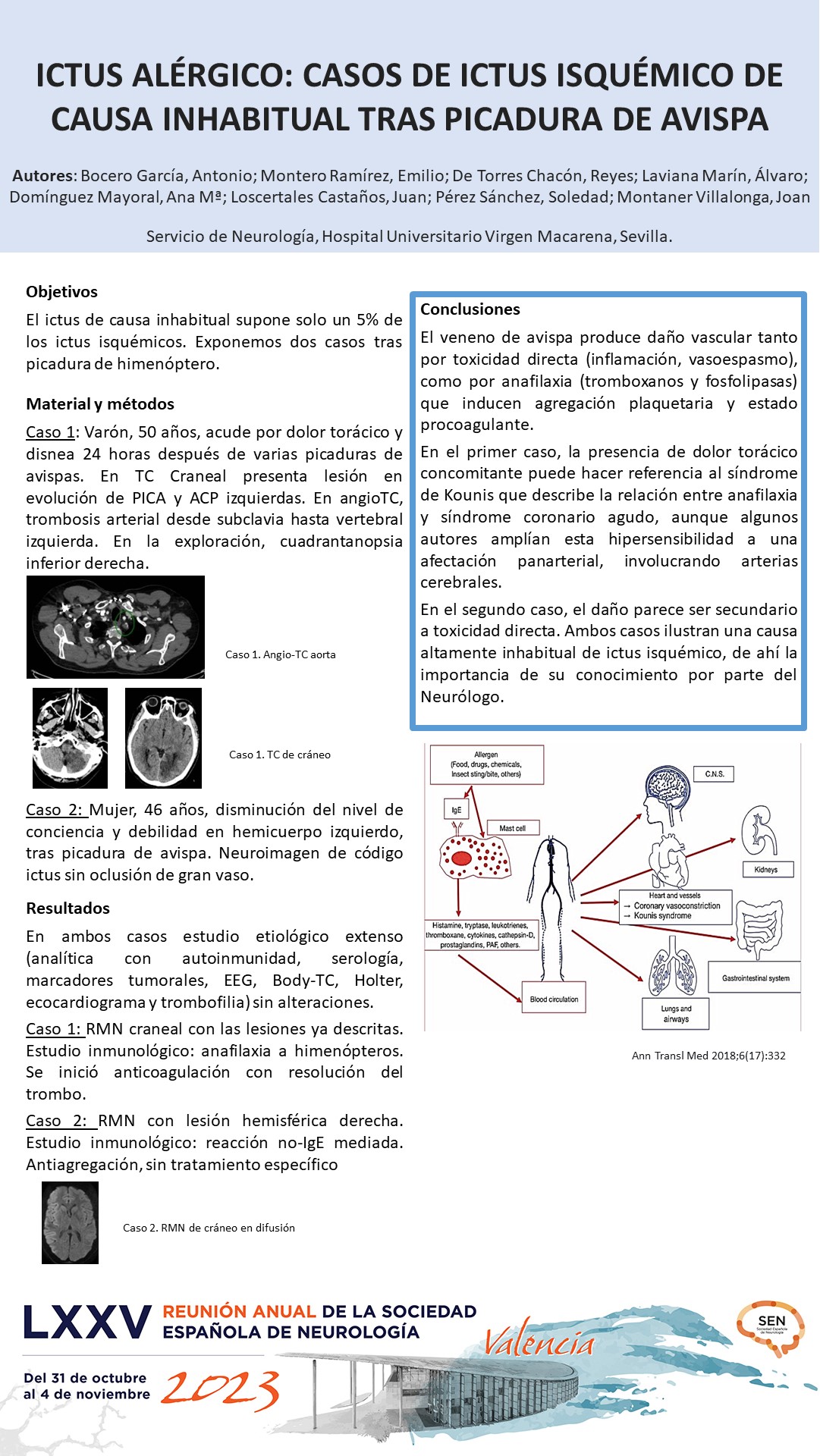 Ictus alérgico: casos de ictus isquémico de causa inhabitual tras picadura de avispa