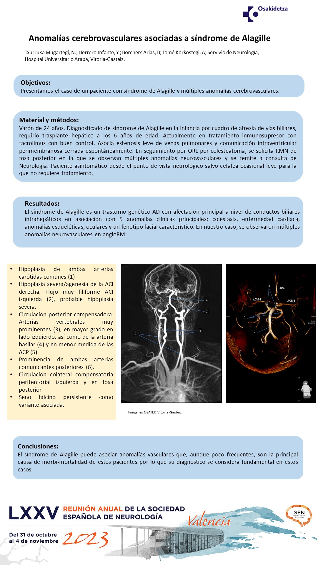 Anomalías cerebrovasculares asociadas a síndrome de Alagille
