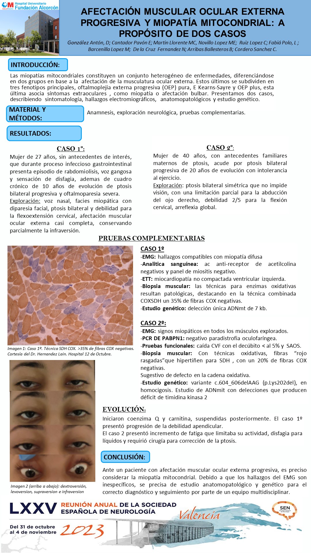 Afectación muscular ocular externa progresiva y miopatía mitocondrial: a propósito de dos casos