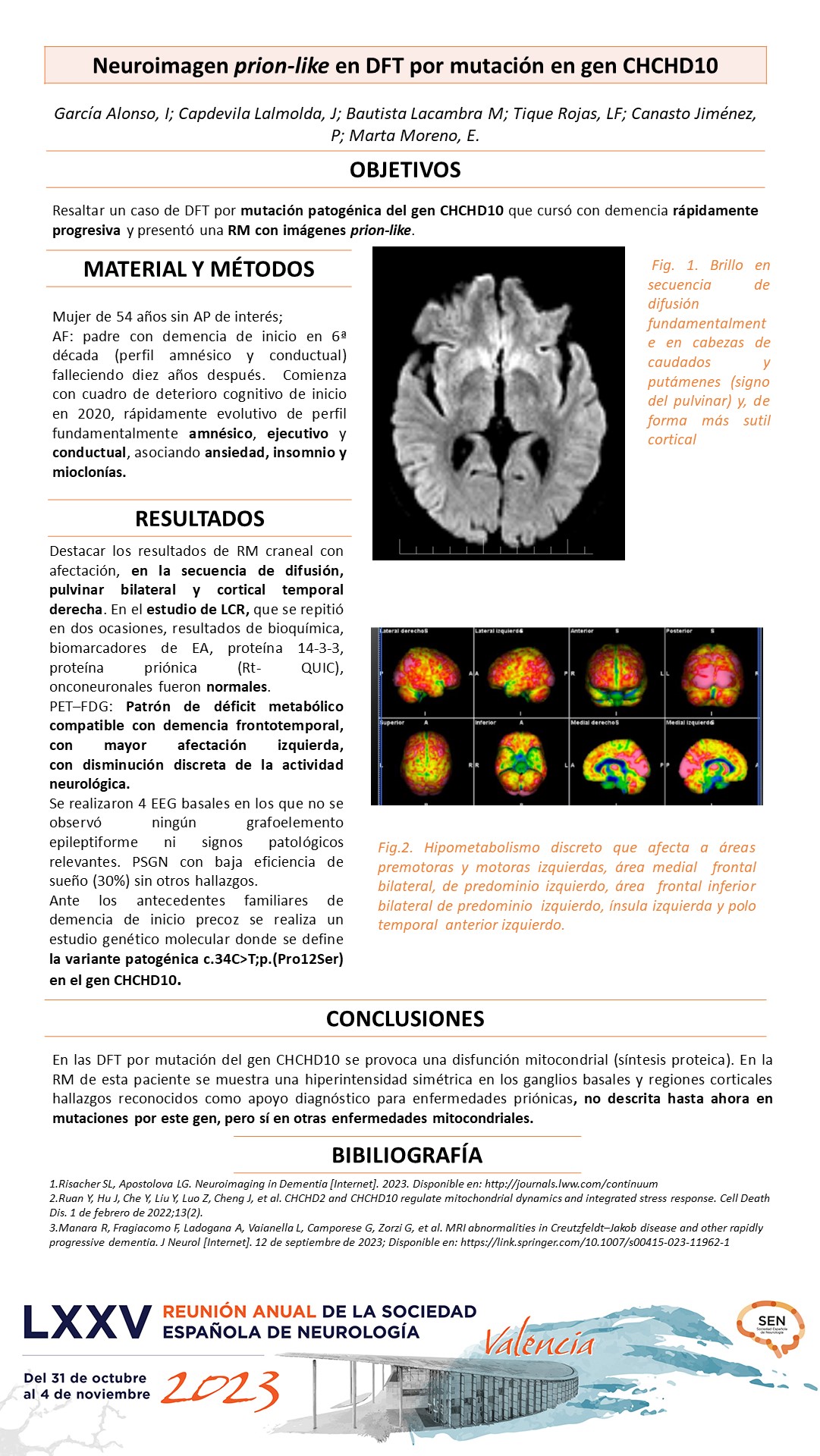 Neuroimagen prion-like en DFT por mutación en gen CHCHD10. 