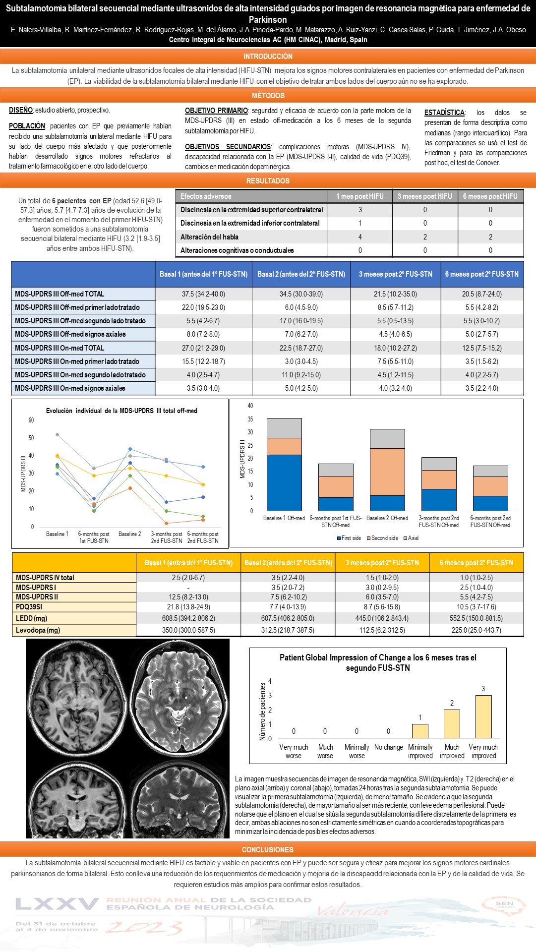 Subtalamotomía secuencial bilateral mediante ultrasonido focal guiado por resonancia magnética para la enfermedad de Parkinson