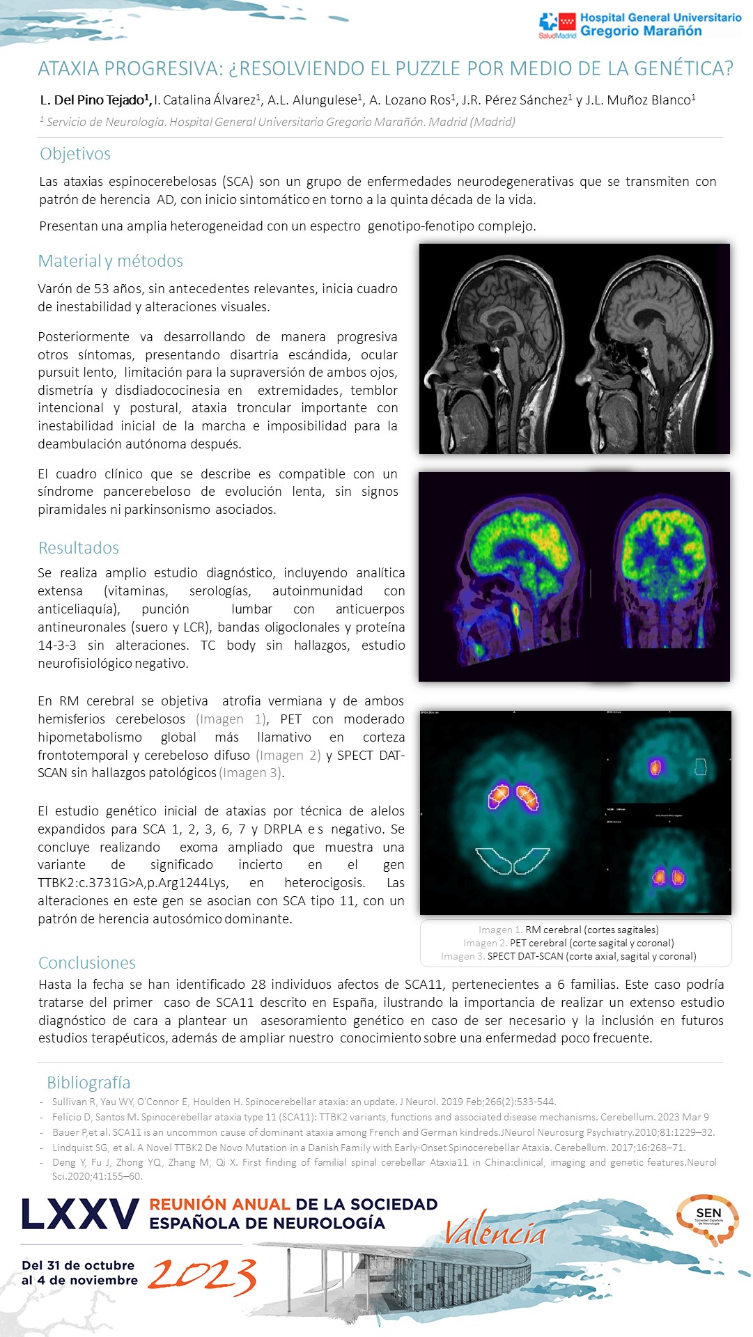 Ataxia progresiva: ¿resolviendo el puzzle por medio de la genética?
