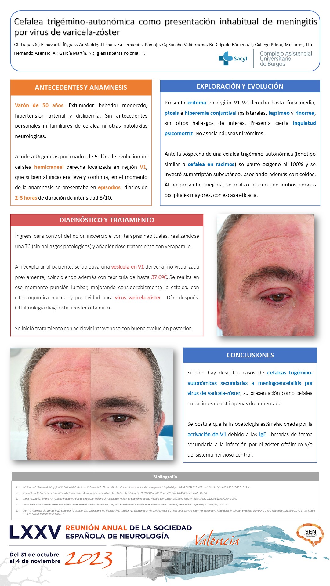Cefalea trigémino-autonómica como presentación inhabitual de meningitis por virus de varicela-zóster