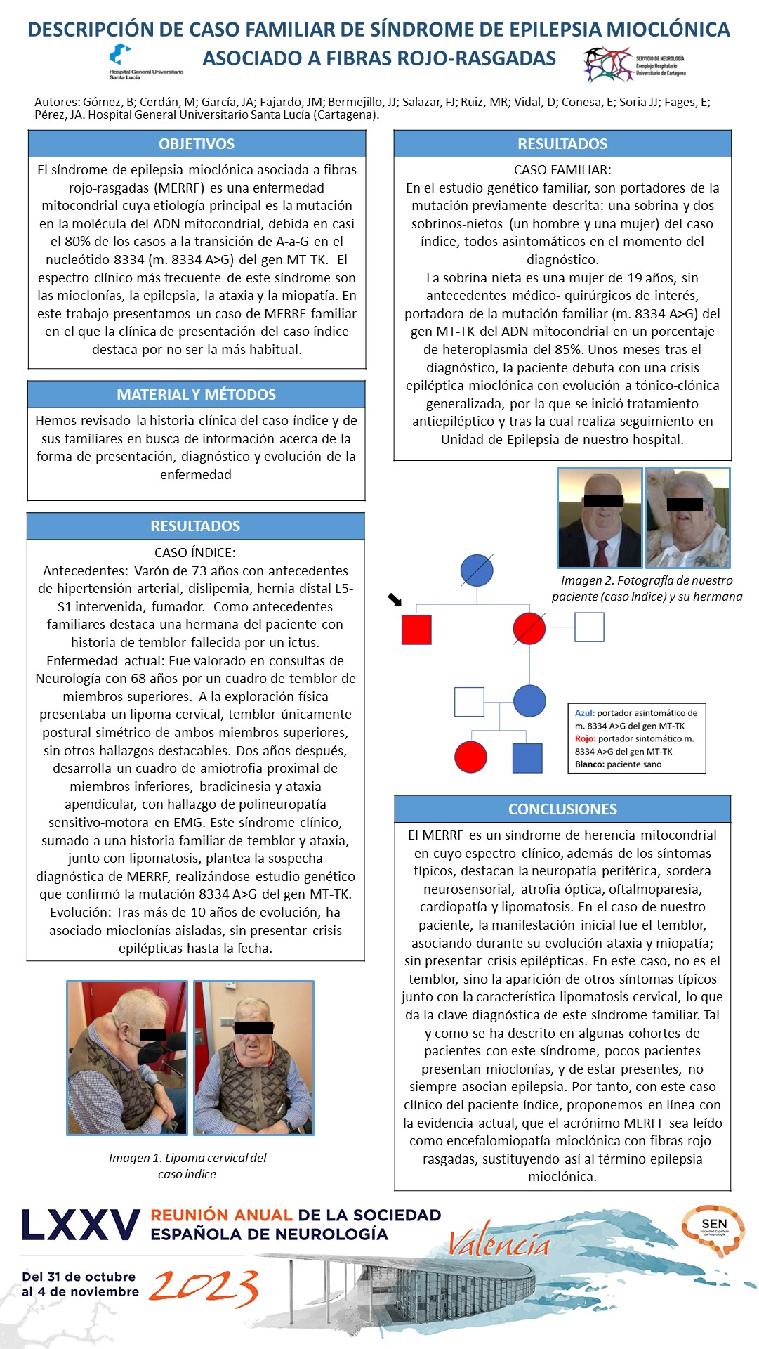 Descripción de caso familiar de síndrome de epilepsia mioclónica asociada a fibras rojo-rasgadas