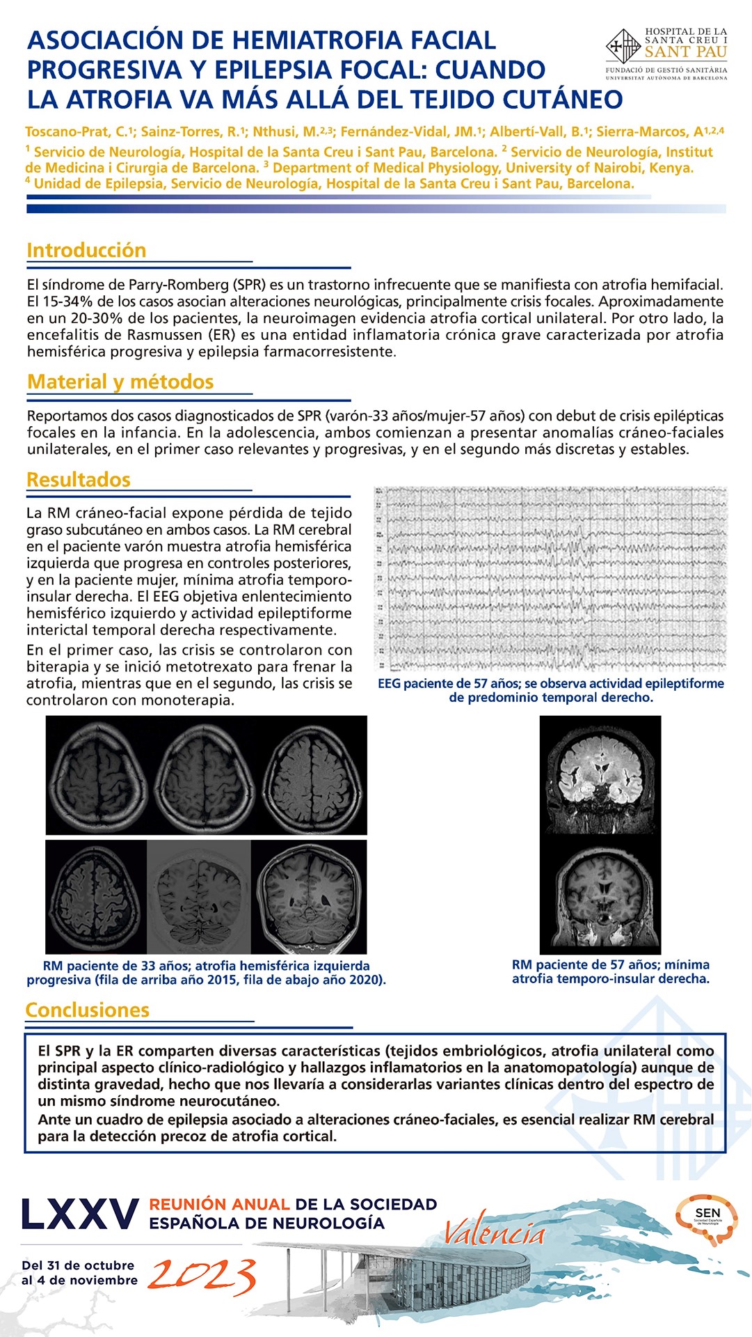 Asociación de hemiatrofia facial progresiva y epilepsia focal: cuando la atrofia va más allá del tejido cutáneo