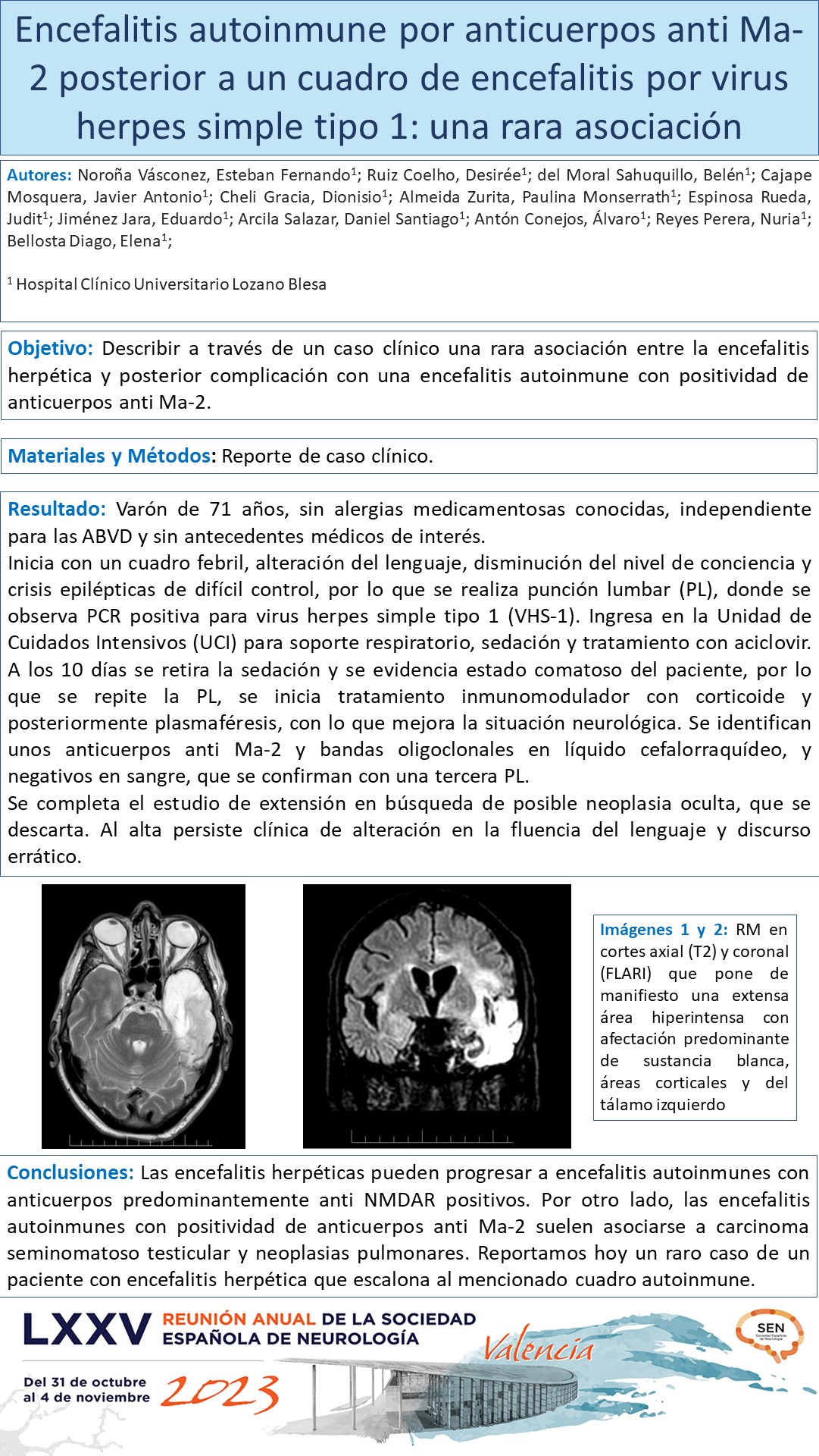 Encefalitis autoinmune por anticuerpos anti Ma-2 posterior a un cuadro de encefalitis por virus herpes simple tipo 1: una rara asociación