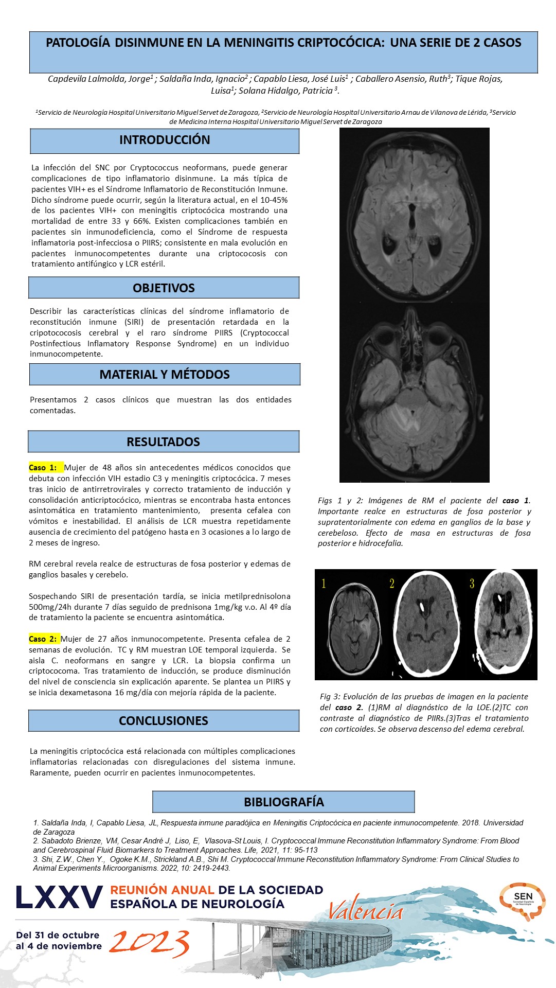 Patología disinmune en la meningitis criptocócica: una serie de 2 casos