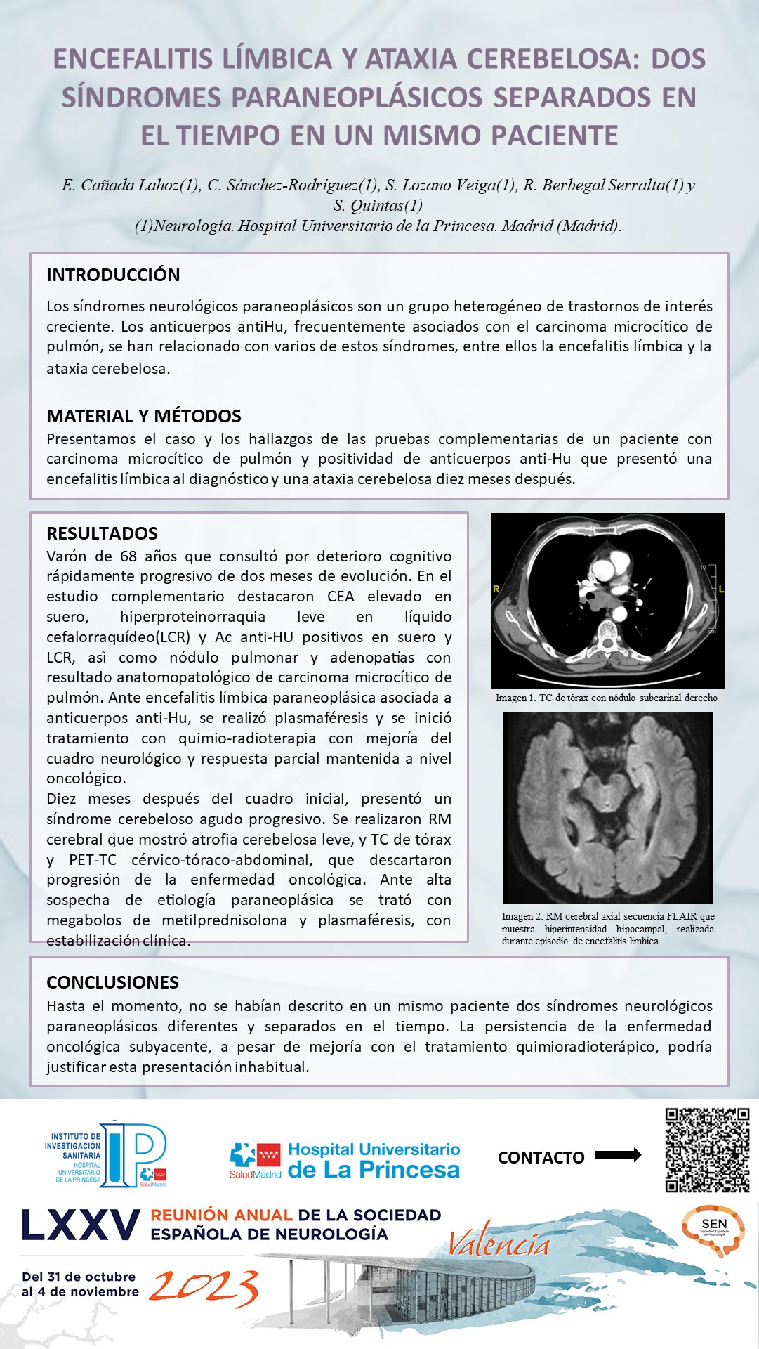 Encefalitis límbica y ataxia cerebelosa: dos síndromes paraneoplásicos separados en el tiempo en un mismo paciente