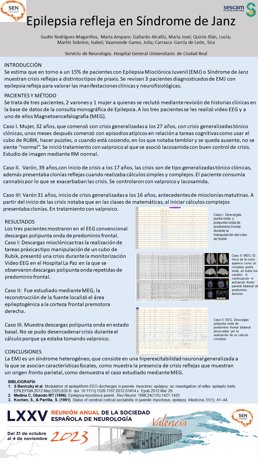Epilepsia refleja en Síndrome de Janz