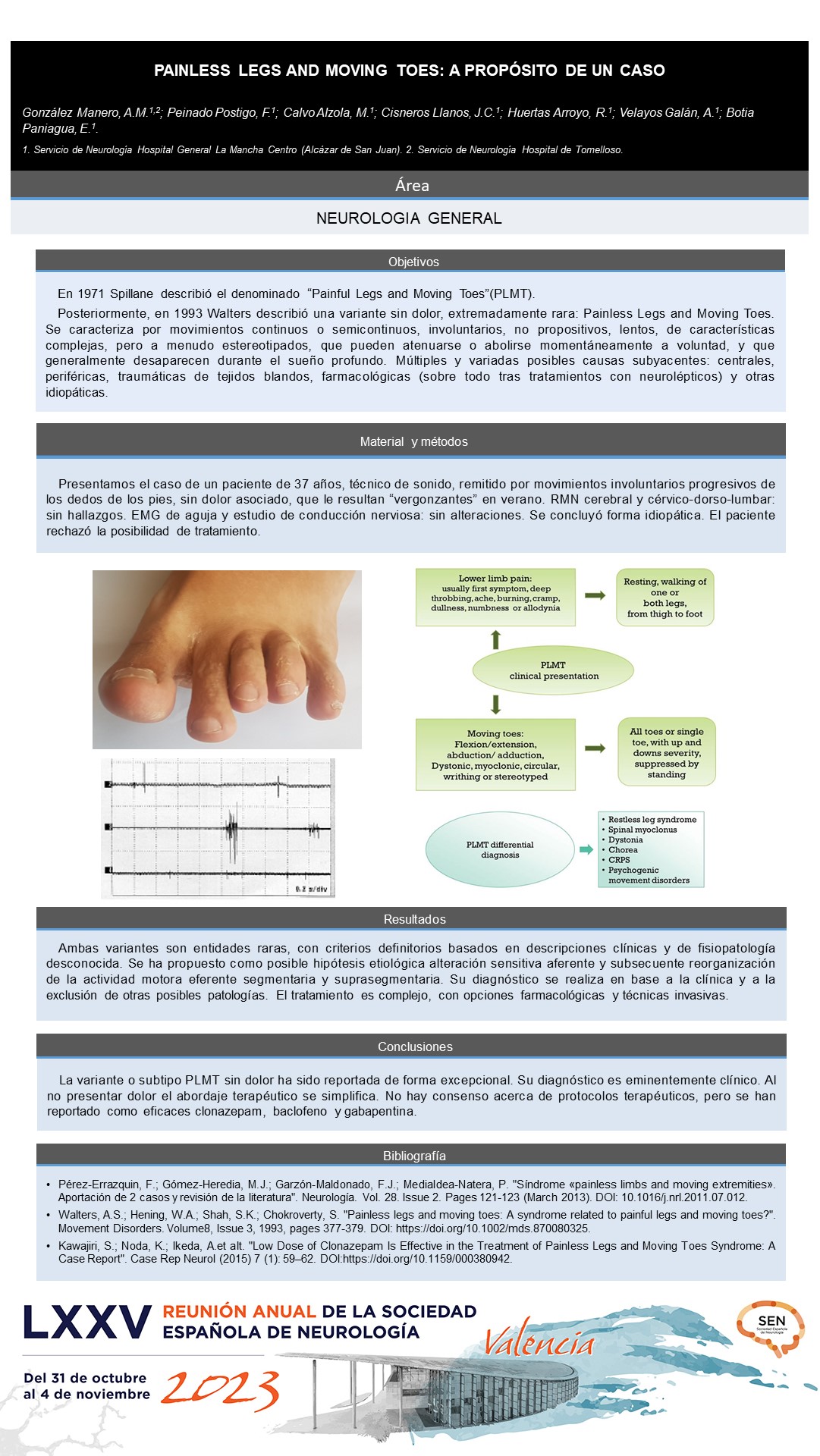 Painless legs and moving toes: a propósito de un caso