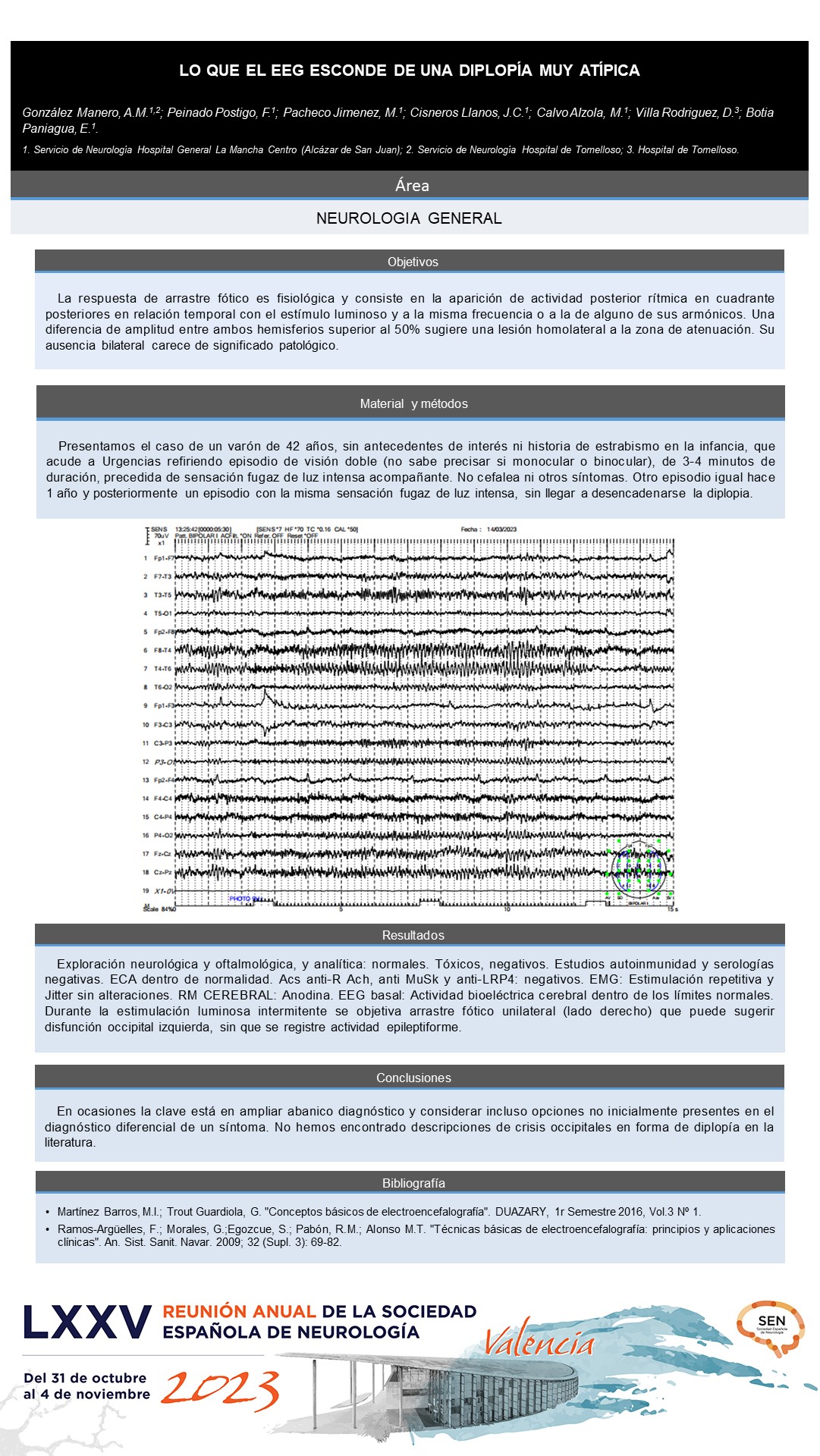 Lo que el EEG esconde de una diplopía muy atípica