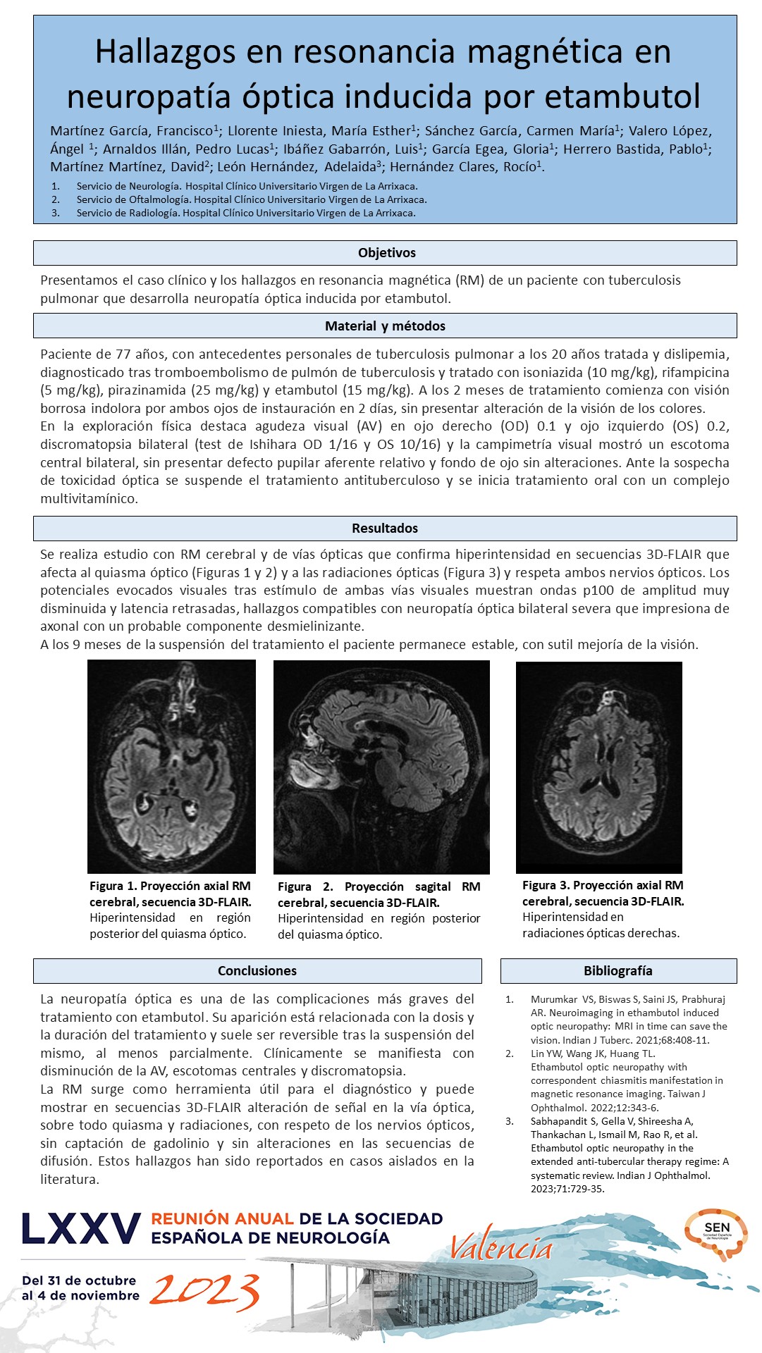 Hallazgos en resonancia magnética en neuropatía óptica inducida por etambutol