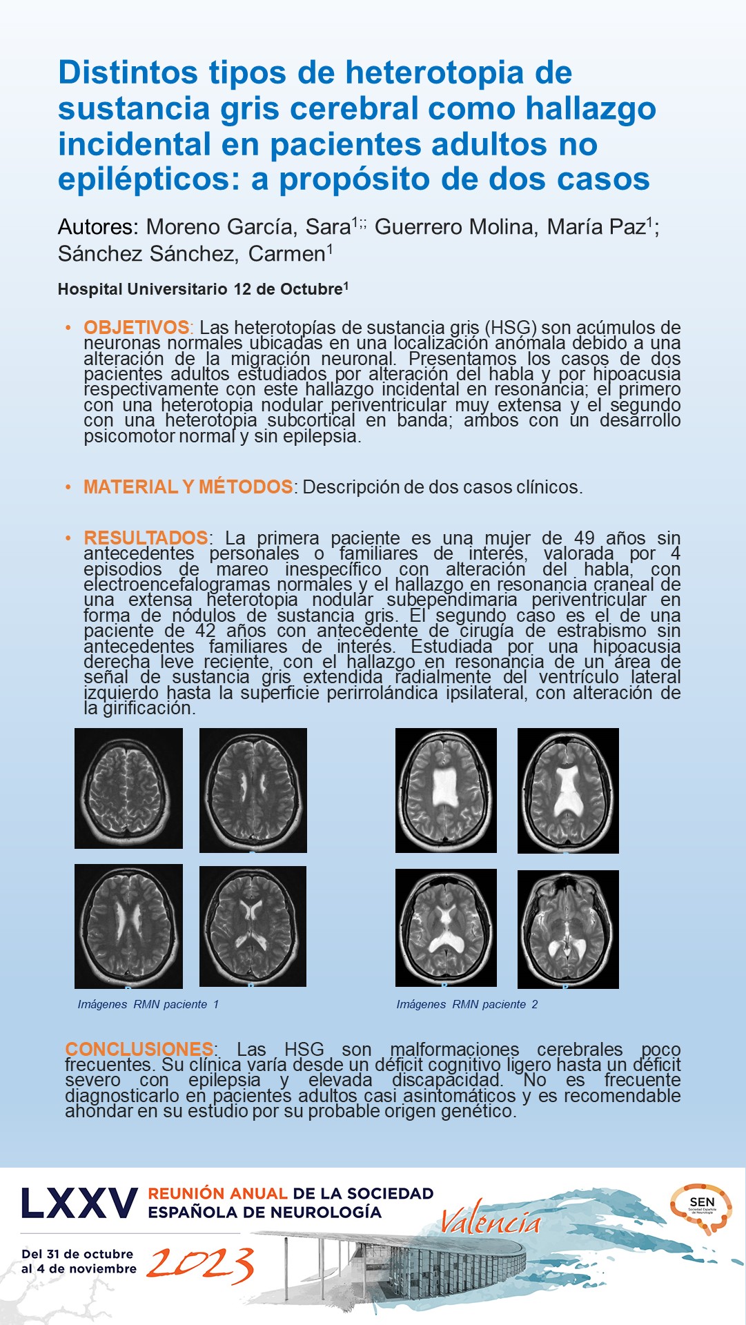 Distintos tipos de heterotopia de sustancia gris cerebral como hallazgo incidental en pacientes adultos no epilépticos: a propósito de dos casos