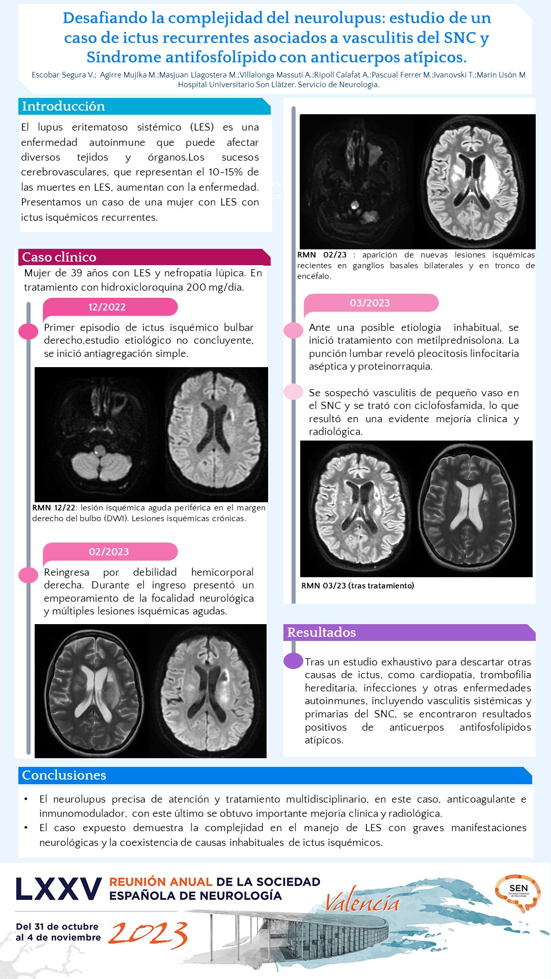 Desafiando la complejidad del lupus neuropsiquiátrico: estudio de un caso de ictus recurrentes asociados a vasculitis del SNC y Síndrome antifosfolípido con anticuerpos atípicos