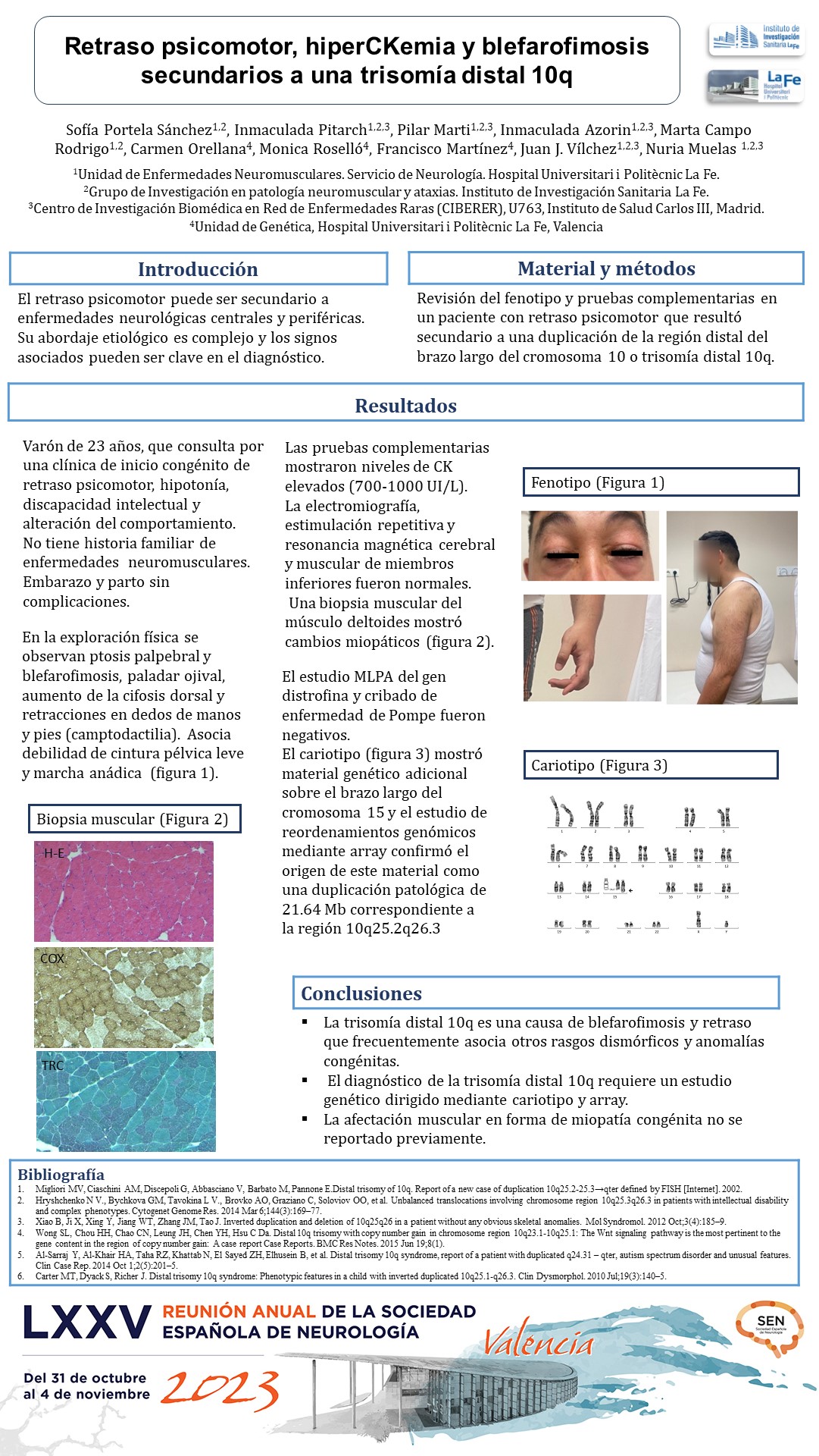 Retraso psicomotor, hiperCKemia y blefarofimosis secundarios a una trisomía distal 10q
