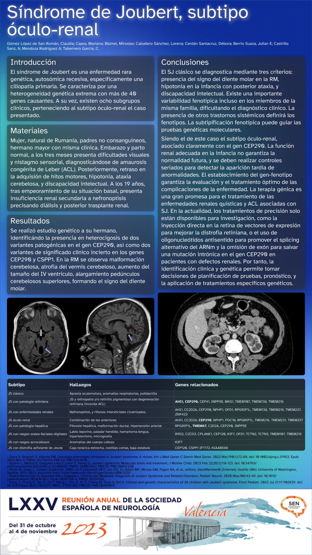 Síndrome de Joubert, subtipo óculo-renal