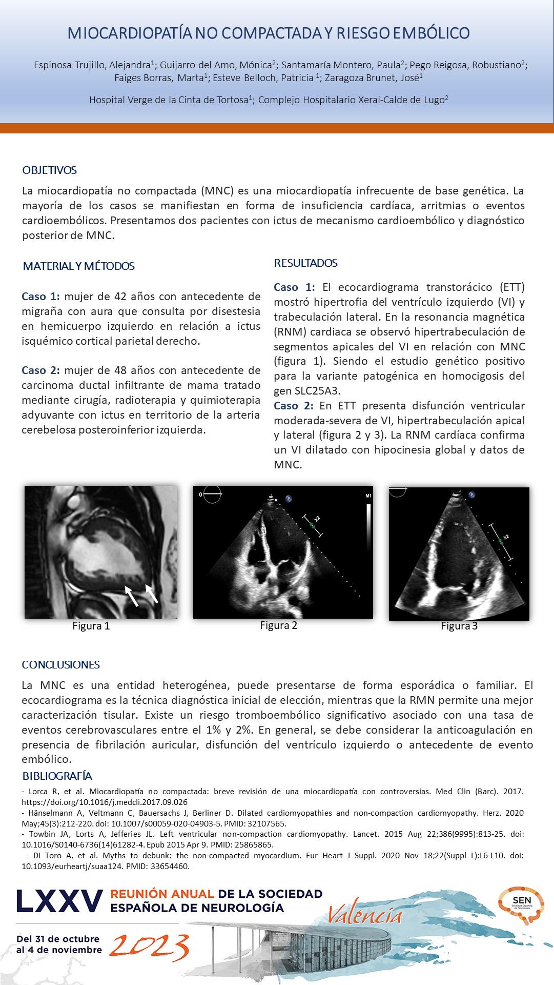 Miocardiopatía no compactada y riesgo embólico