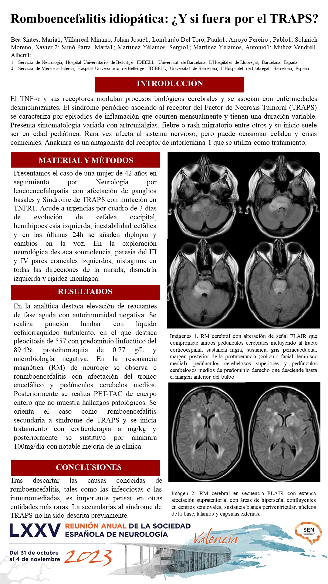 Romboencefalitis idiopática: ¿Y si fuera por el TRAPS?
