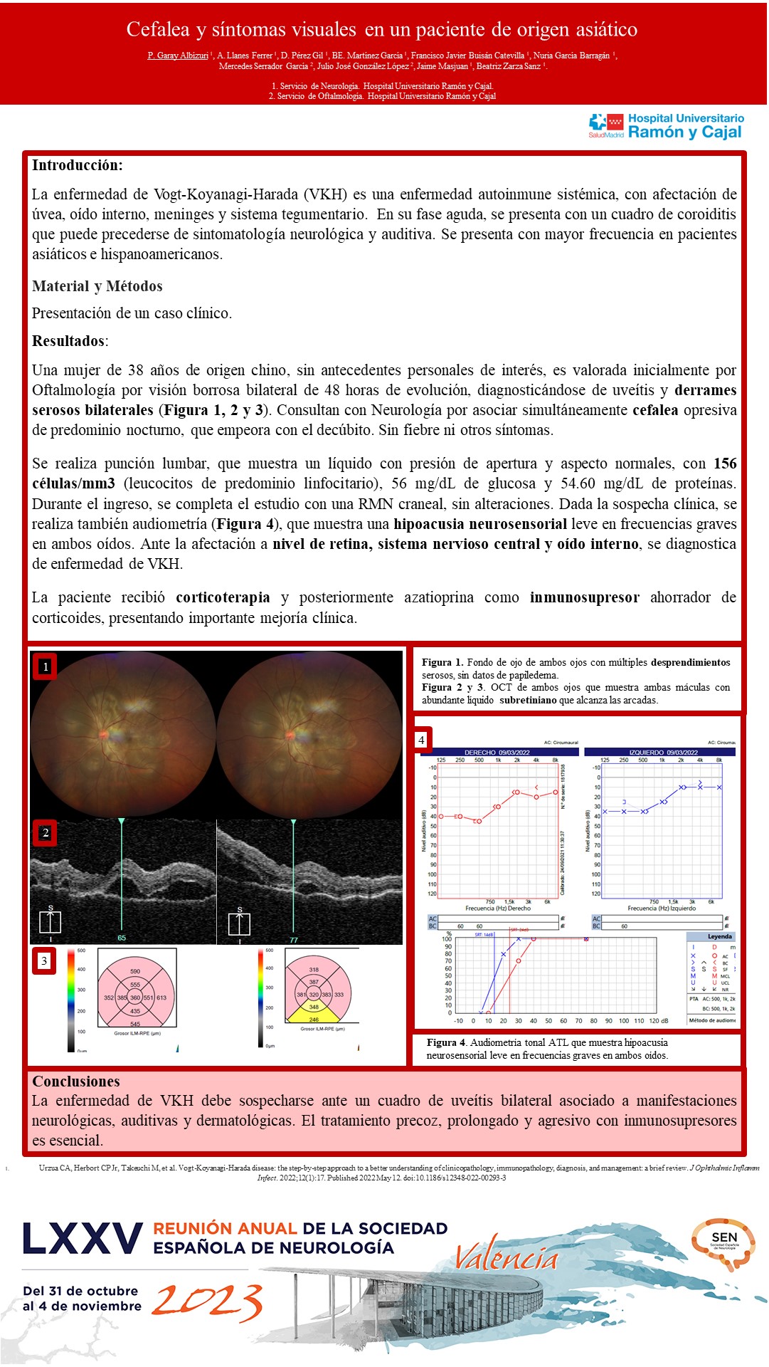 Cefalea y síntomas visuales en paciente de origen asiático 