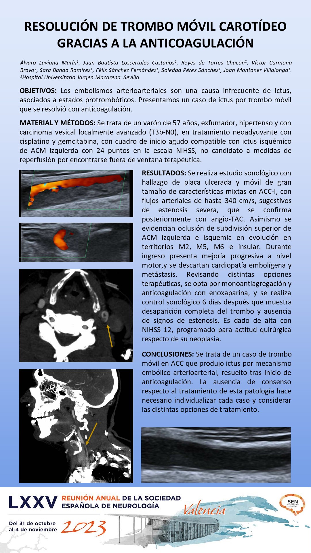 Resolución de trombo móvil carotídeo gracias a la anticoagulación
