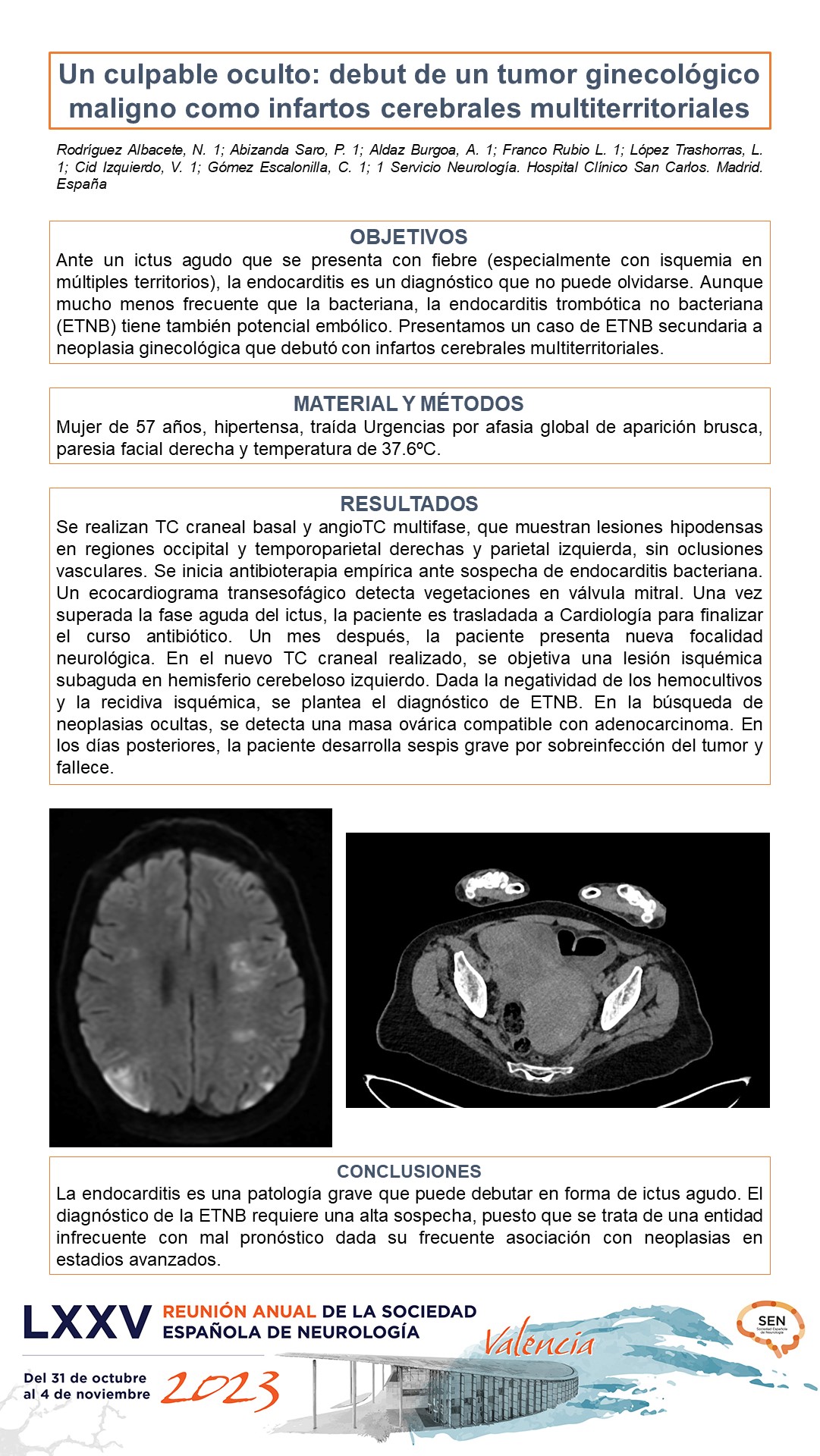 Un culpable oculto: debut de un tumor ginecológico maligno como infartos cerebrales multiterritoriales