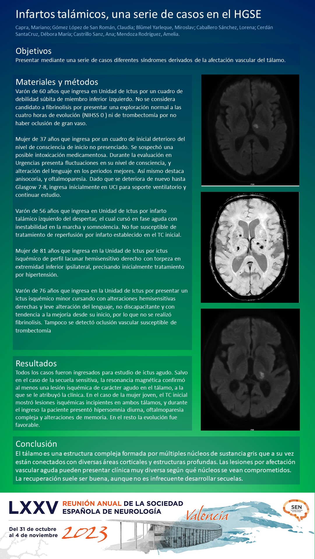 Infartos talámicos, una serie de casos