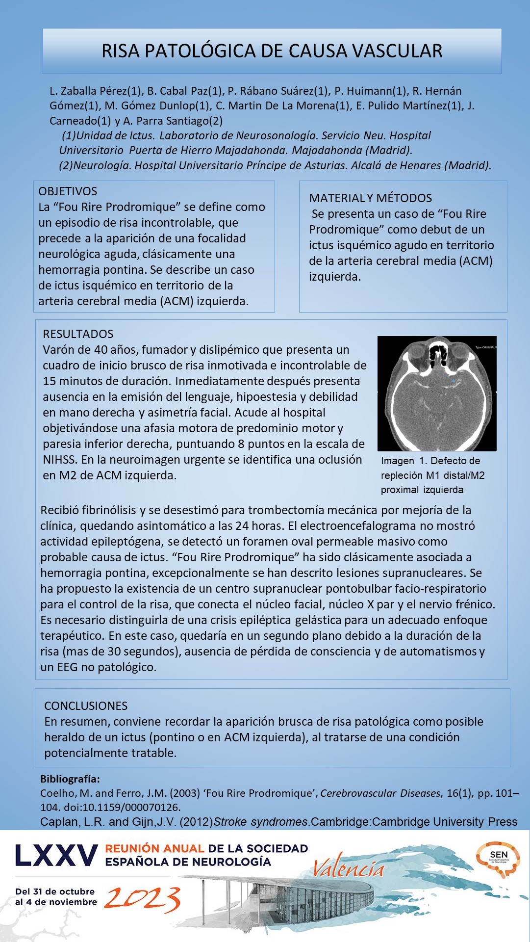 Risa patológica de causa vascular