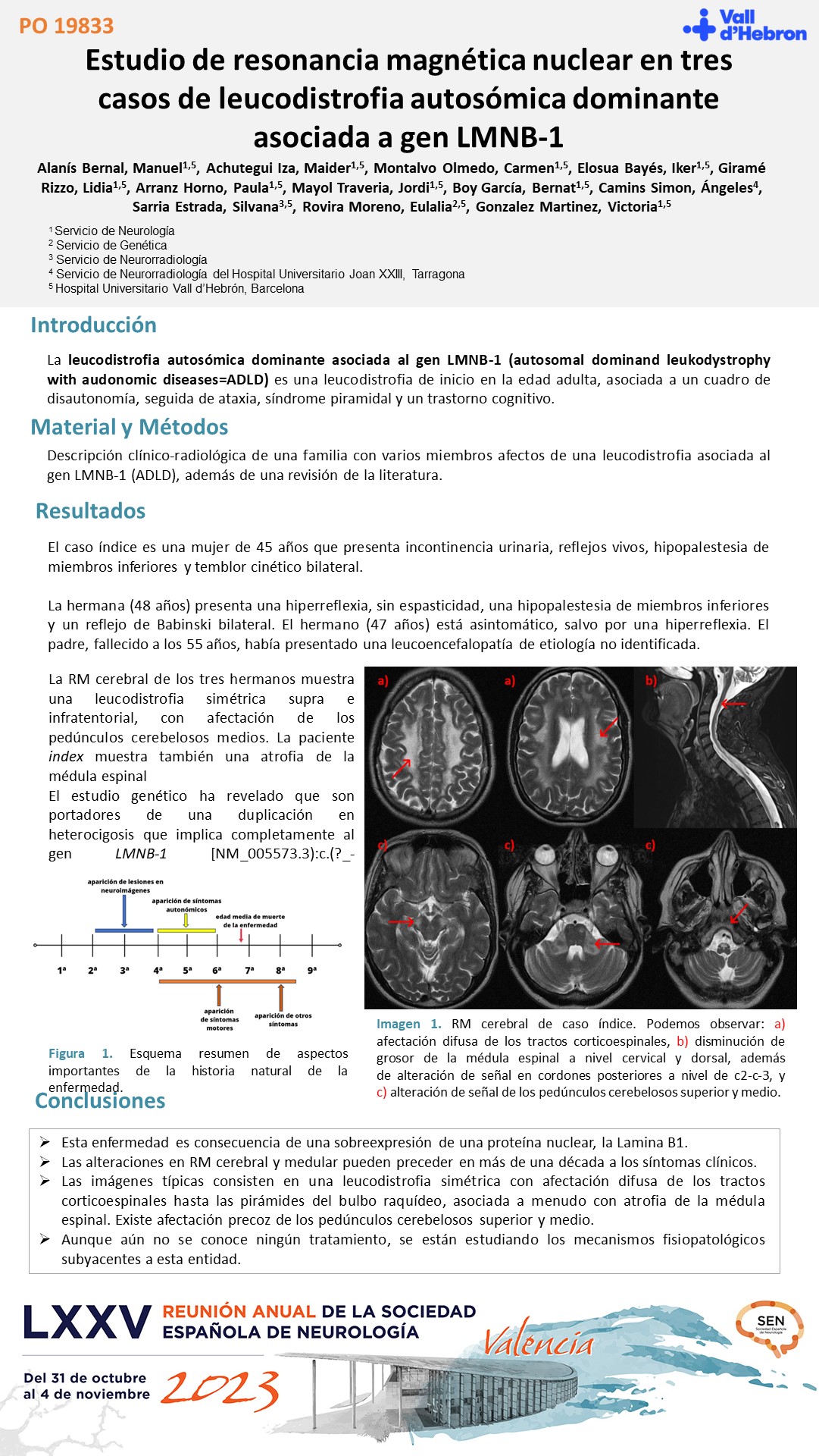 Estudio de resonancia magnética nuclear en tres casos de leucodistrofia autosómica dominante asociada a gen LMNB-1