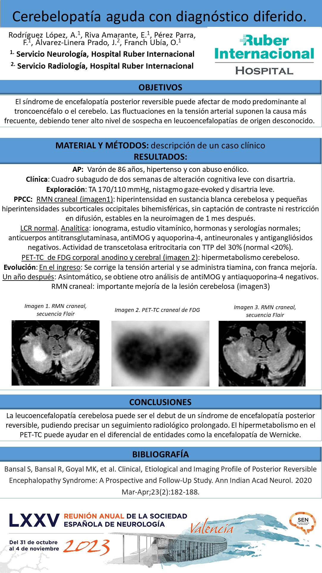 Cerebelopatía aguda con diagnóstico diferido