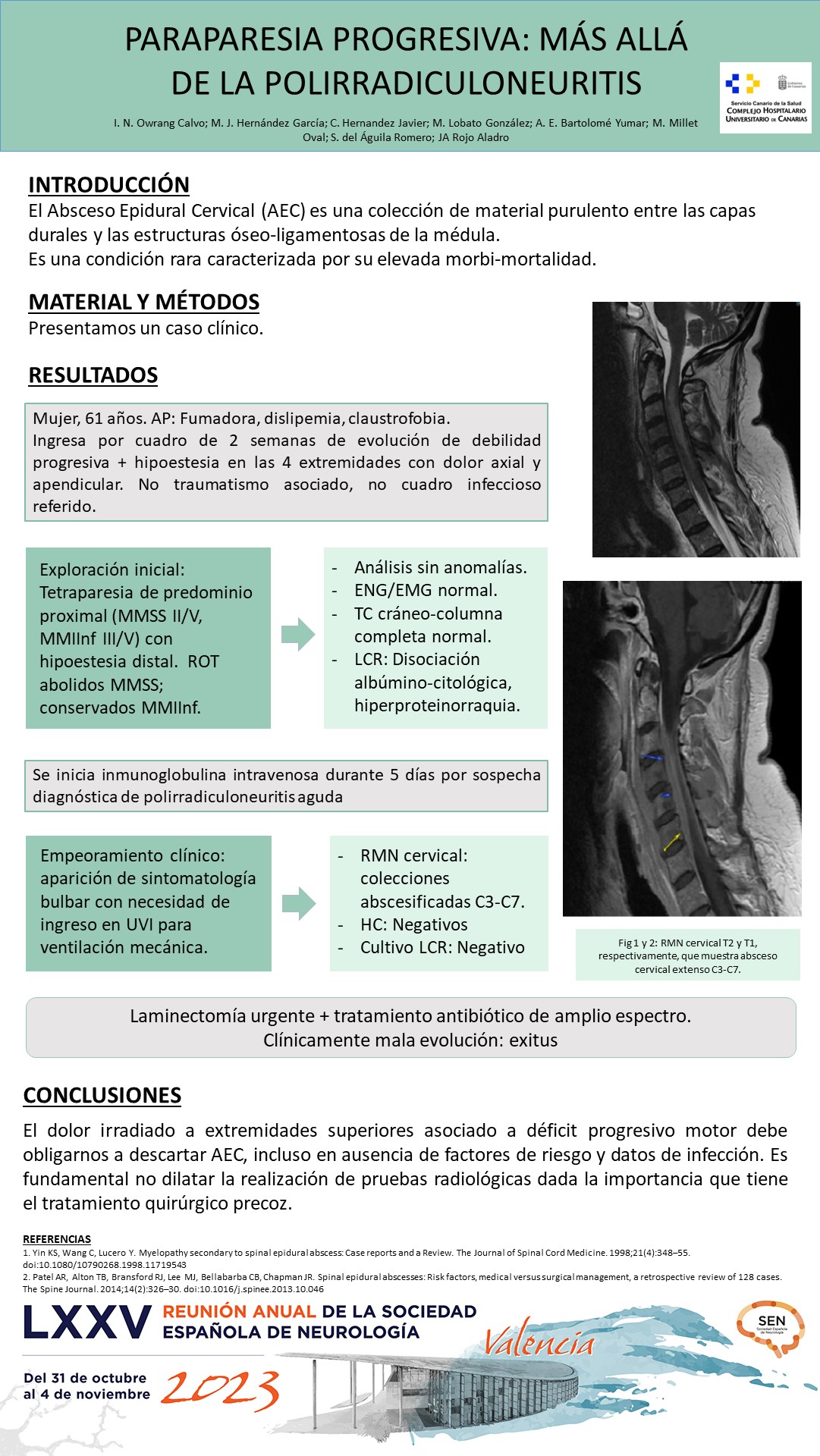 Paraparesia progresiva: más allá de la polirradiculoneuritis