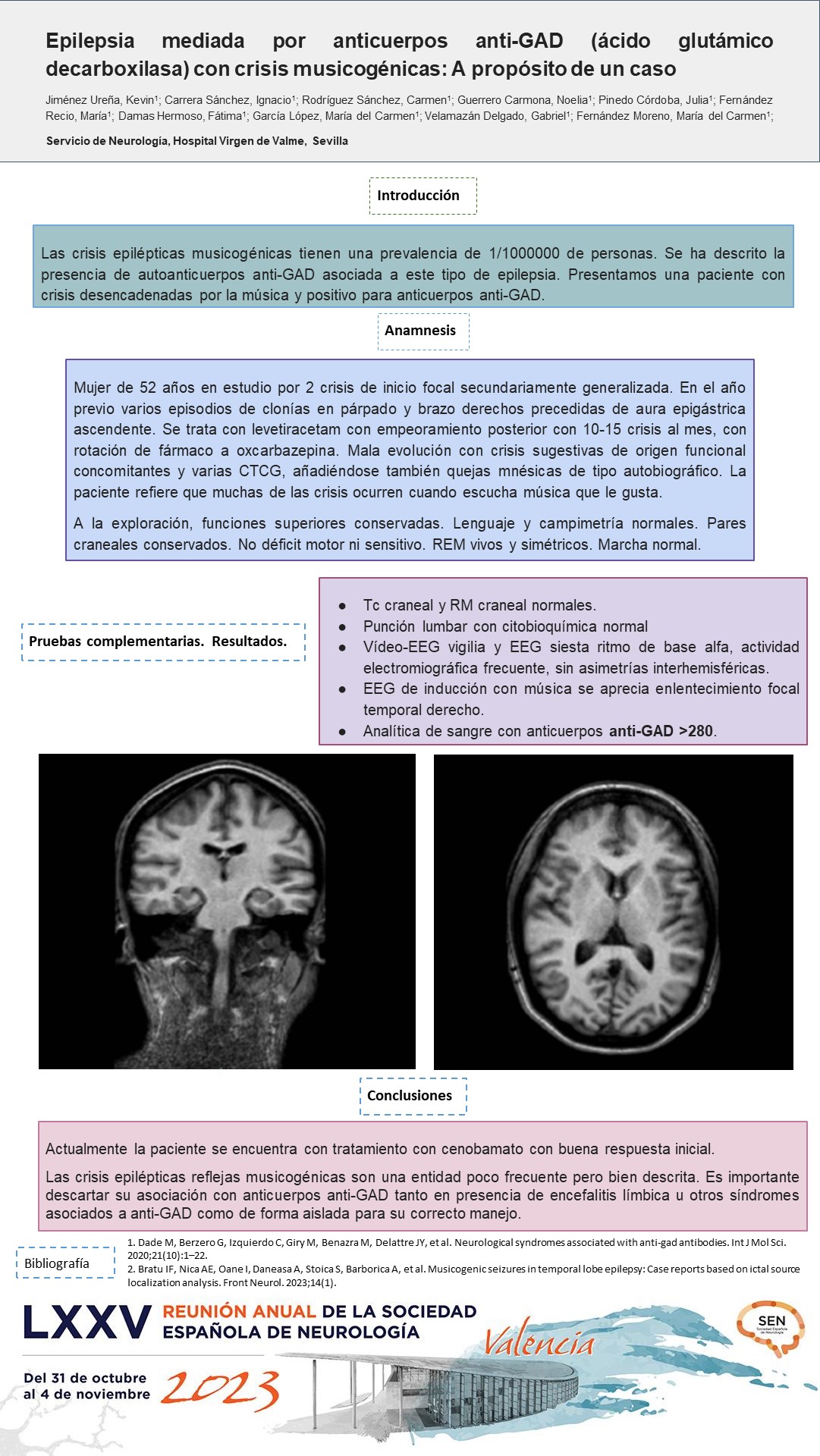 Epilepsia mediada por anticuerpos anti-GAD (ácido glutámico decarboxilasa) con crisis musicogénicas: A propósito de un caso