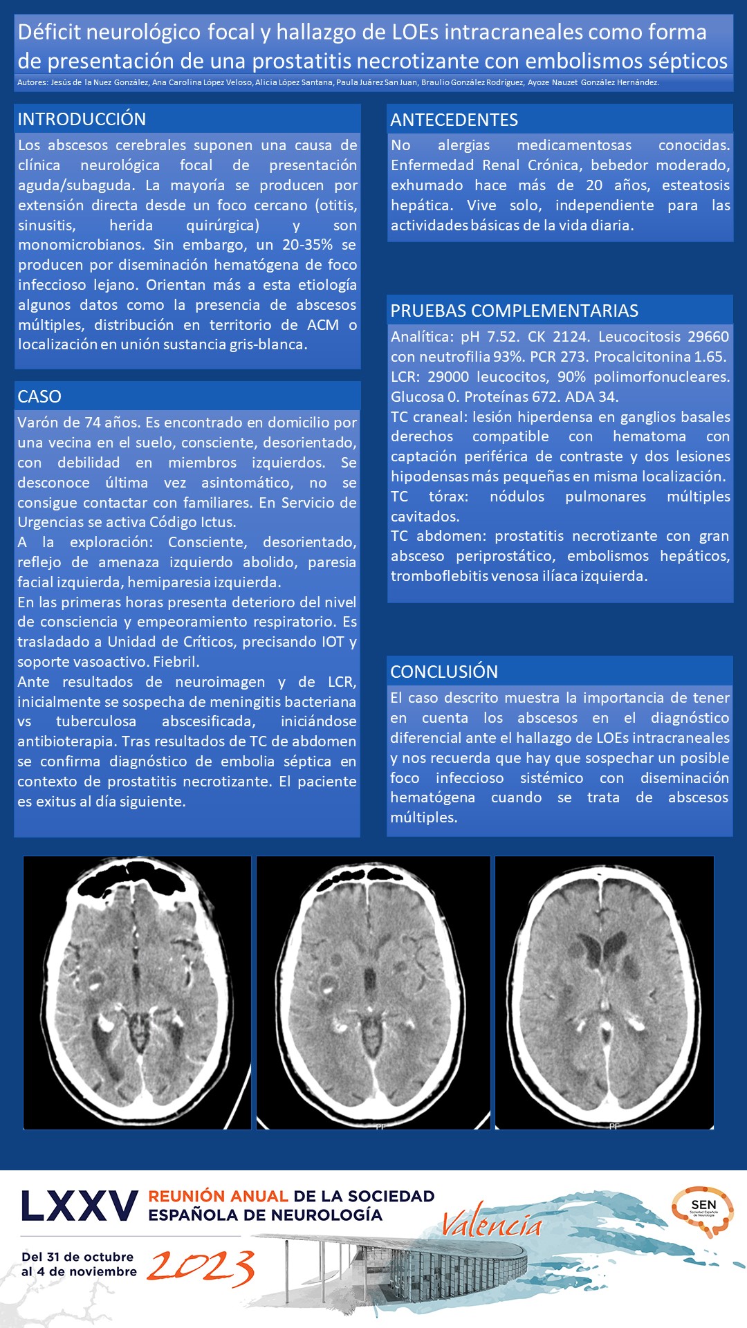 Déficit neurológico focal y hallazgo de LOEs intracraneales como forma de presentación de una prostatitis necrotizante con embolismos sépticos.