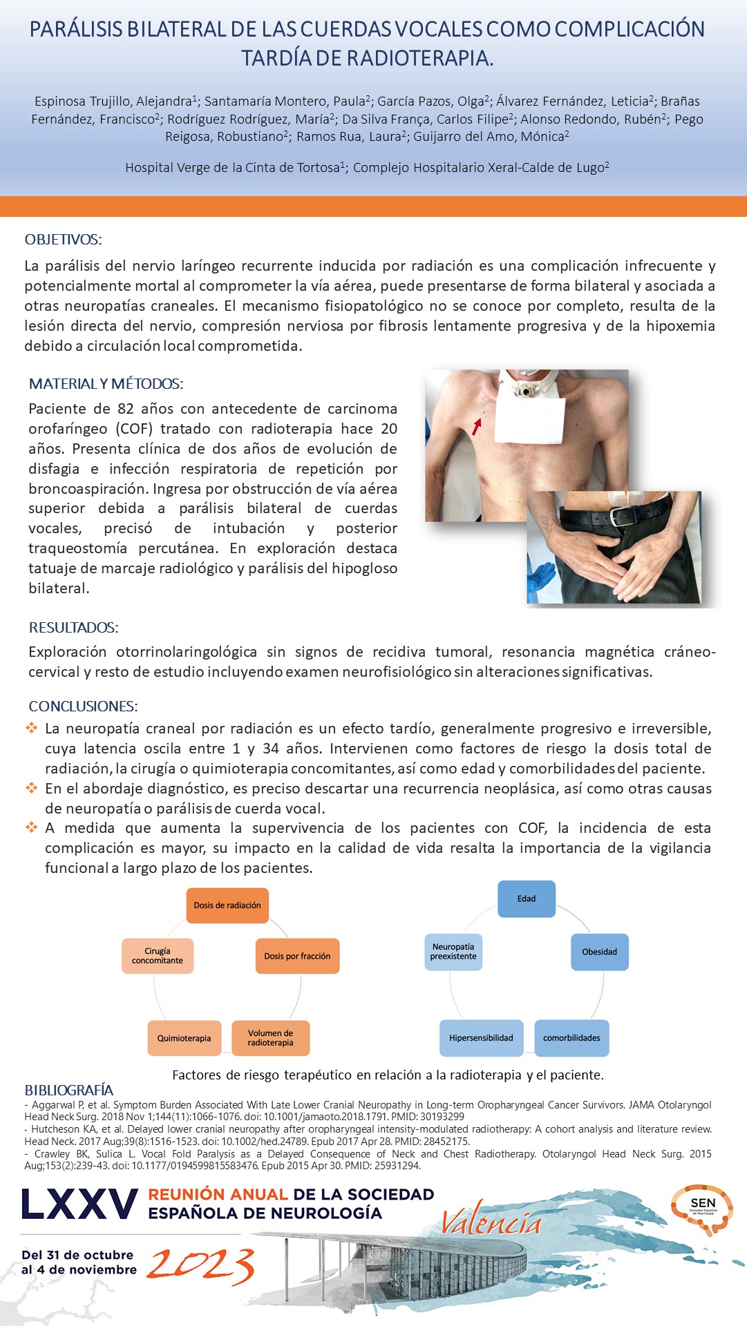 Parálisis bilateral de las cuerdas vocales como complicación tardía de radioterapia.