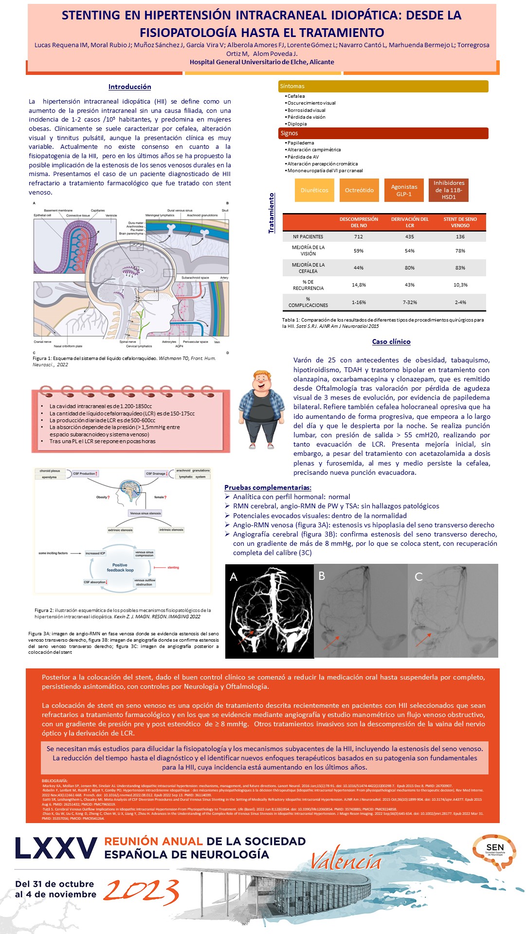 Stenting en hipertensión intracraneal idiopática (HII): desde la fisiopatología hasta el tratamiento