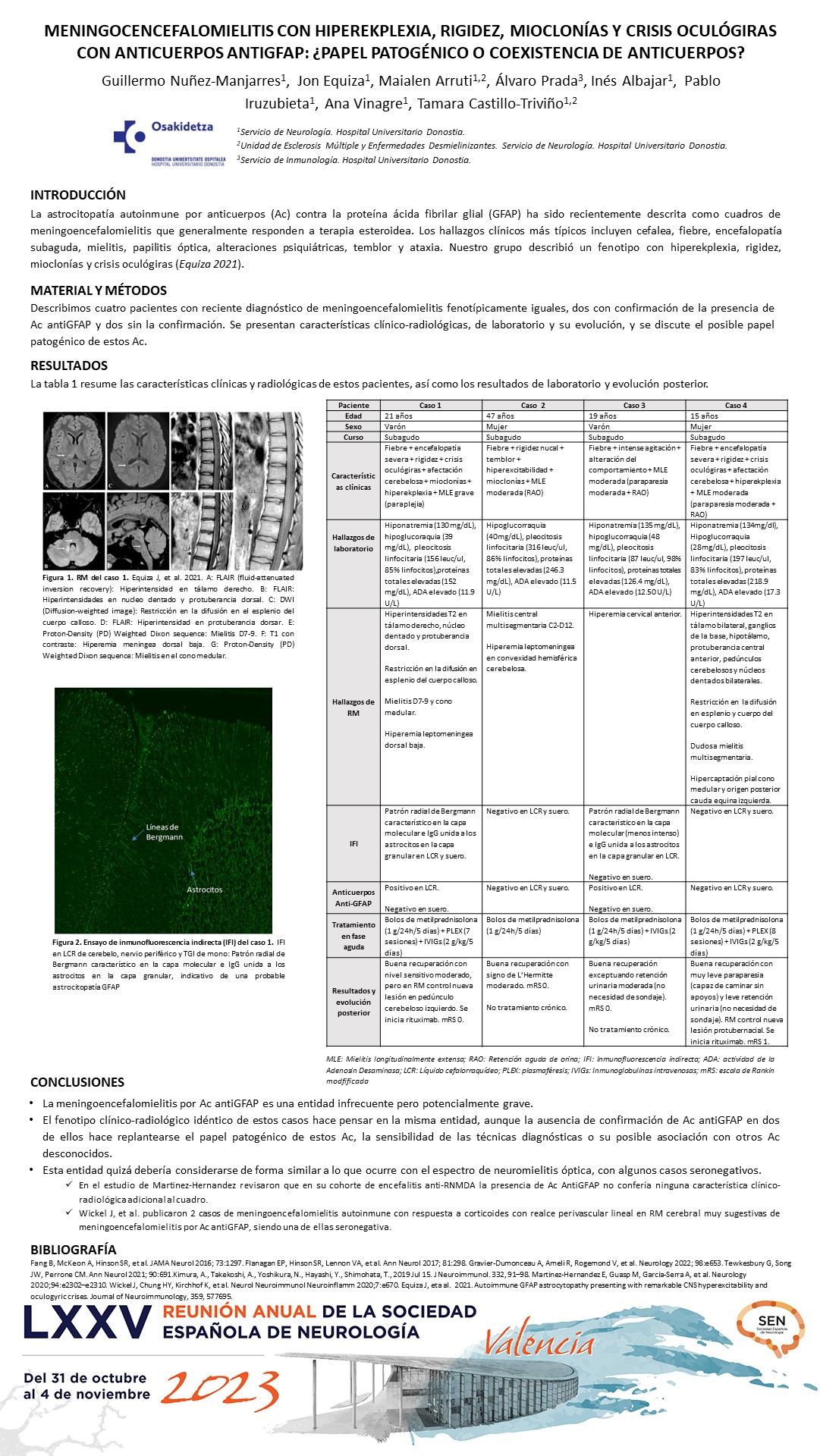 Meningocencefalomielitis con hiperekplexia, rigidez, mioclonías y crisis oculógiras con anticuerpos ANTIGFAP: ¿papel patogénico o coexistencia de anticuerpos?