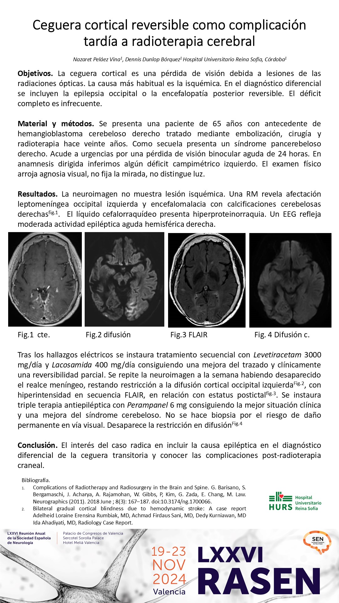 Ceguera cortical reversible como complicación tardía a radioterapia cerebral 