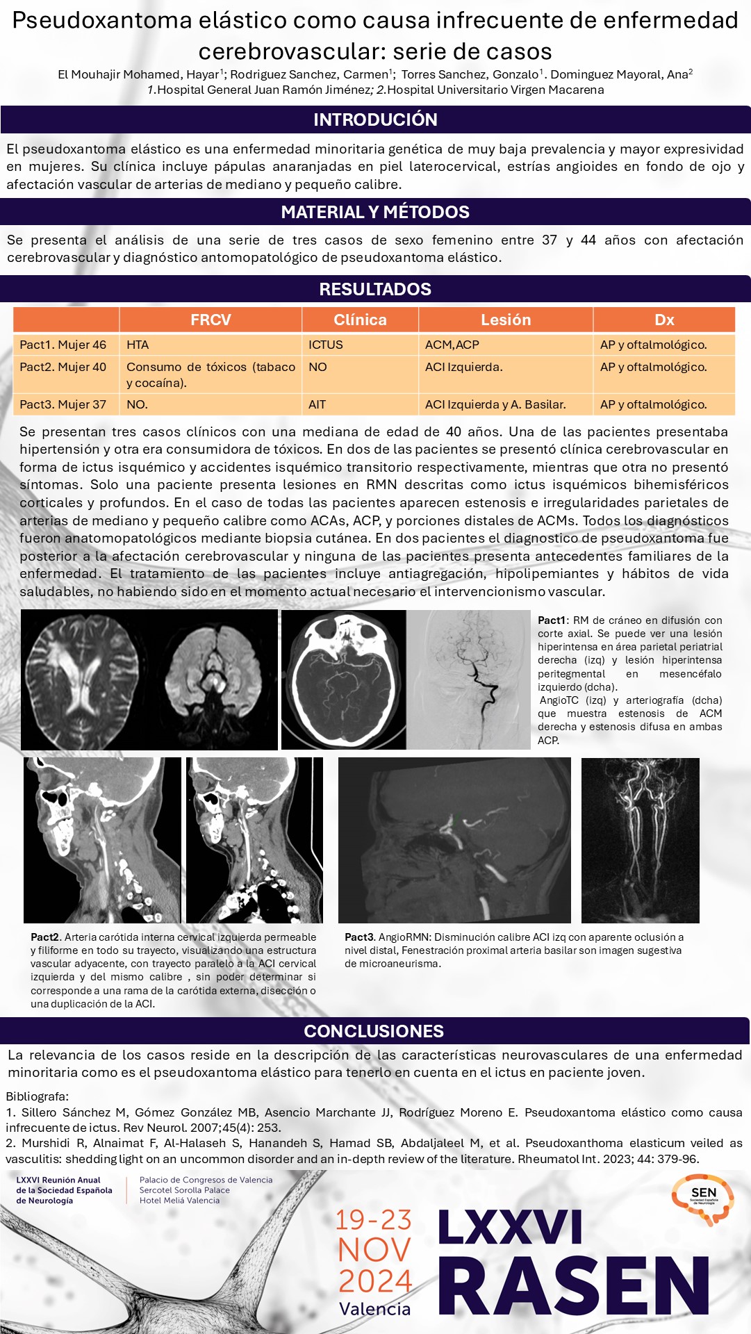 Pseudoxantoma elástico como causa infrecuente de enfermedad cerebrovascular: serie de casos