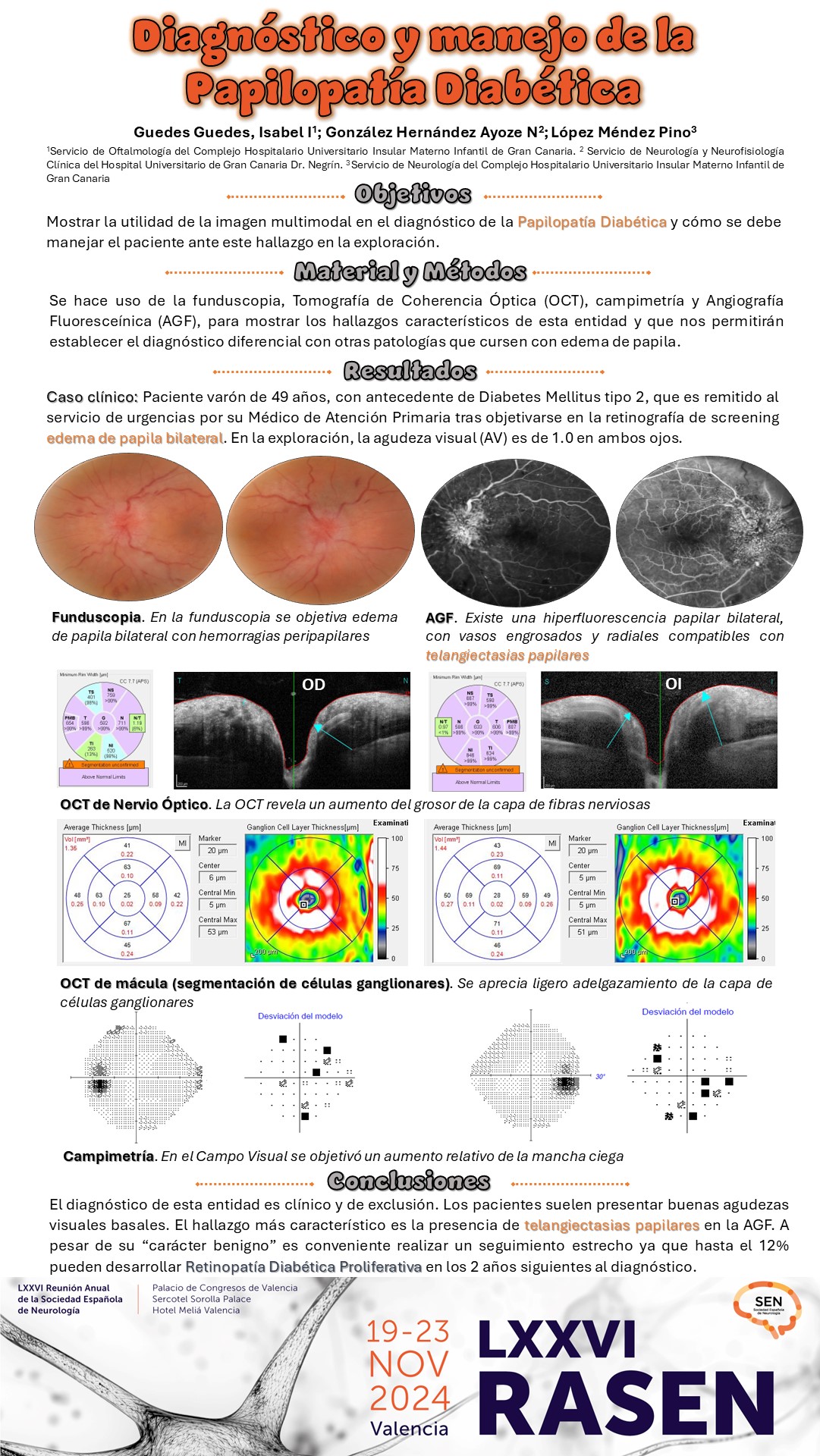 Diagnóstico y manejo de la Papilopatía Diabética