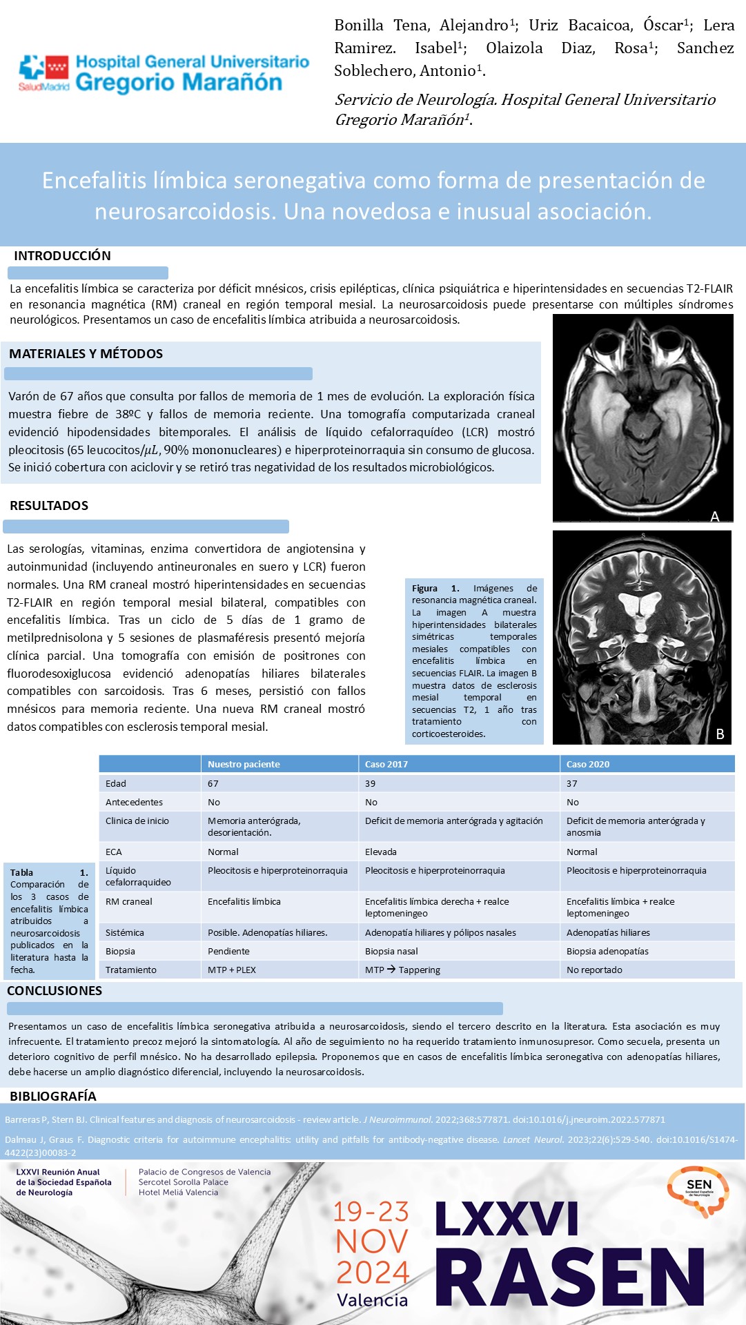 Encefalitis límbica seronegativa como forma de presentación de neurosarcoidosis. Una novedosa e inusual asociación