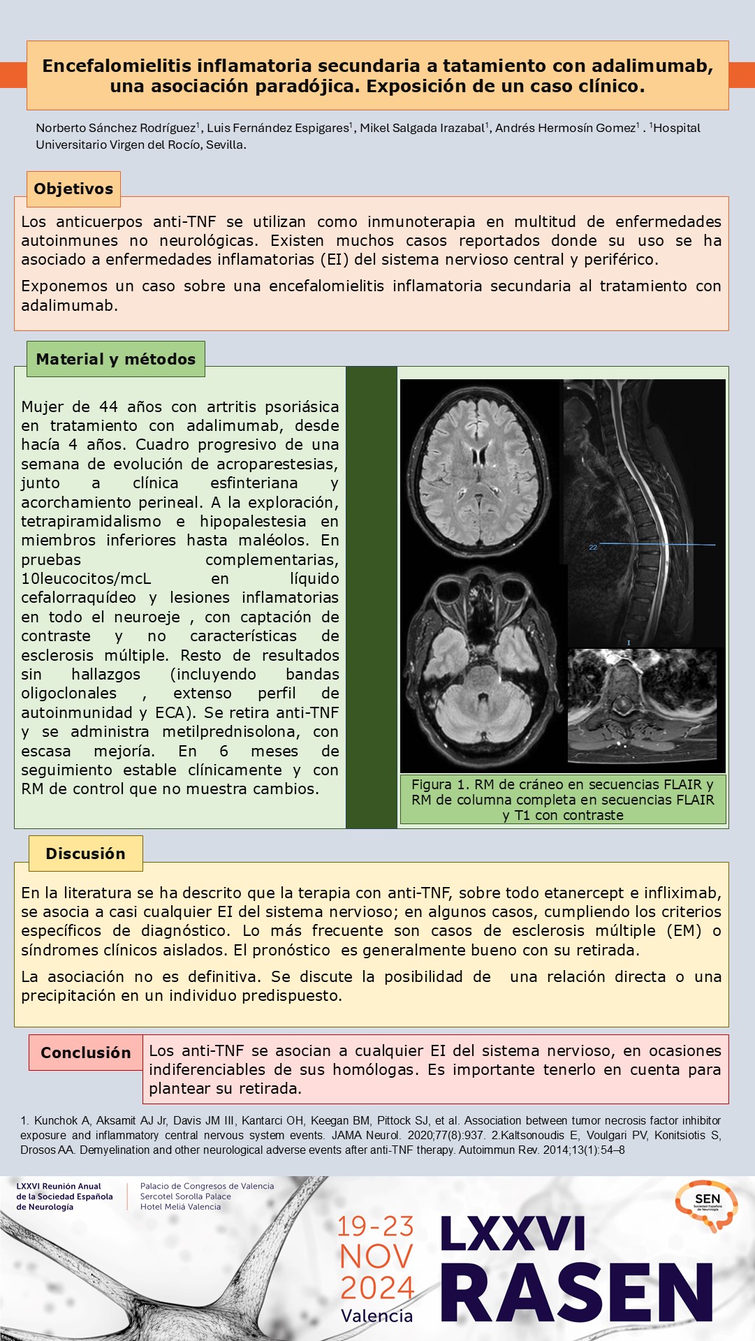 Encefalomielitis inflamatoria secundaria a tratamiento con adalimumab, una asociación paradójica. Exposición de un caso clínico