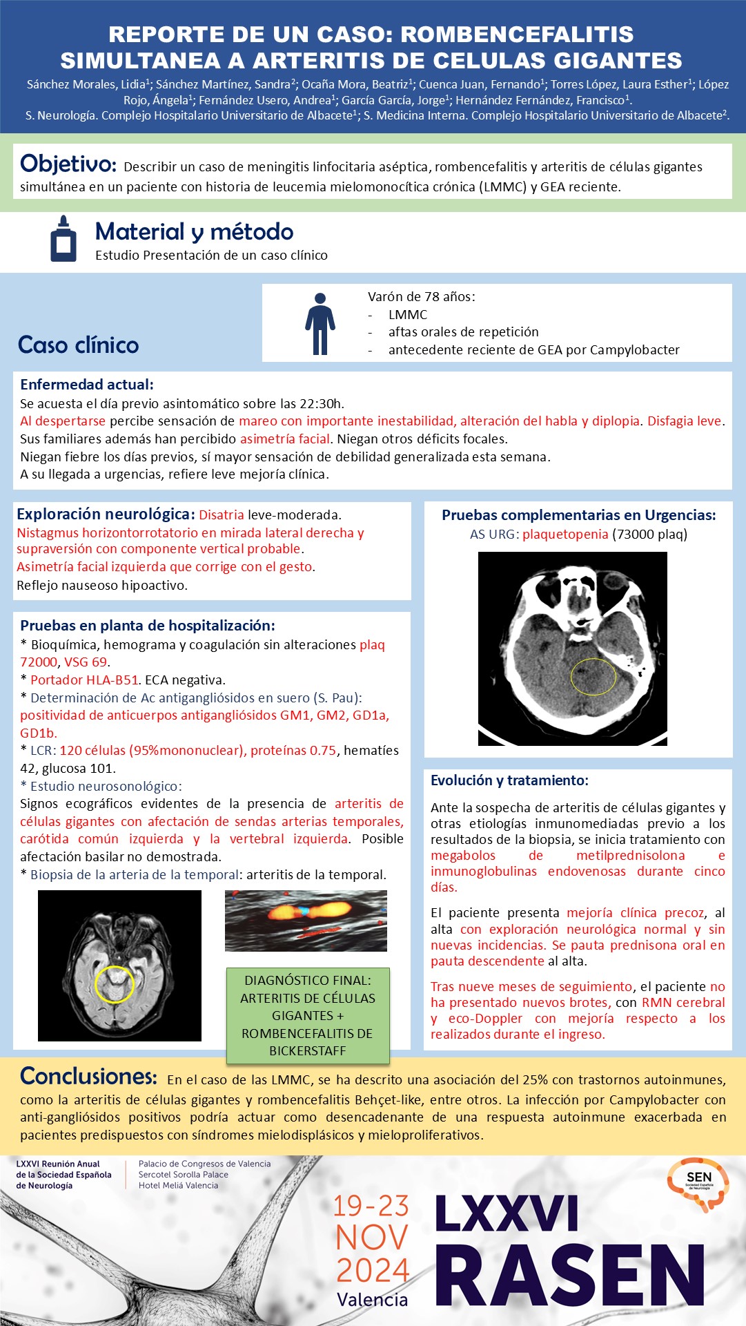 Reporte de un caso: rombencefalitis simultánea a arteritis de células gigantes