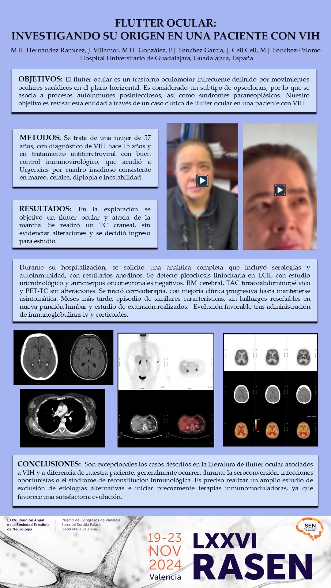 Flutter ocular: investigando su origen en una paciente con VIH