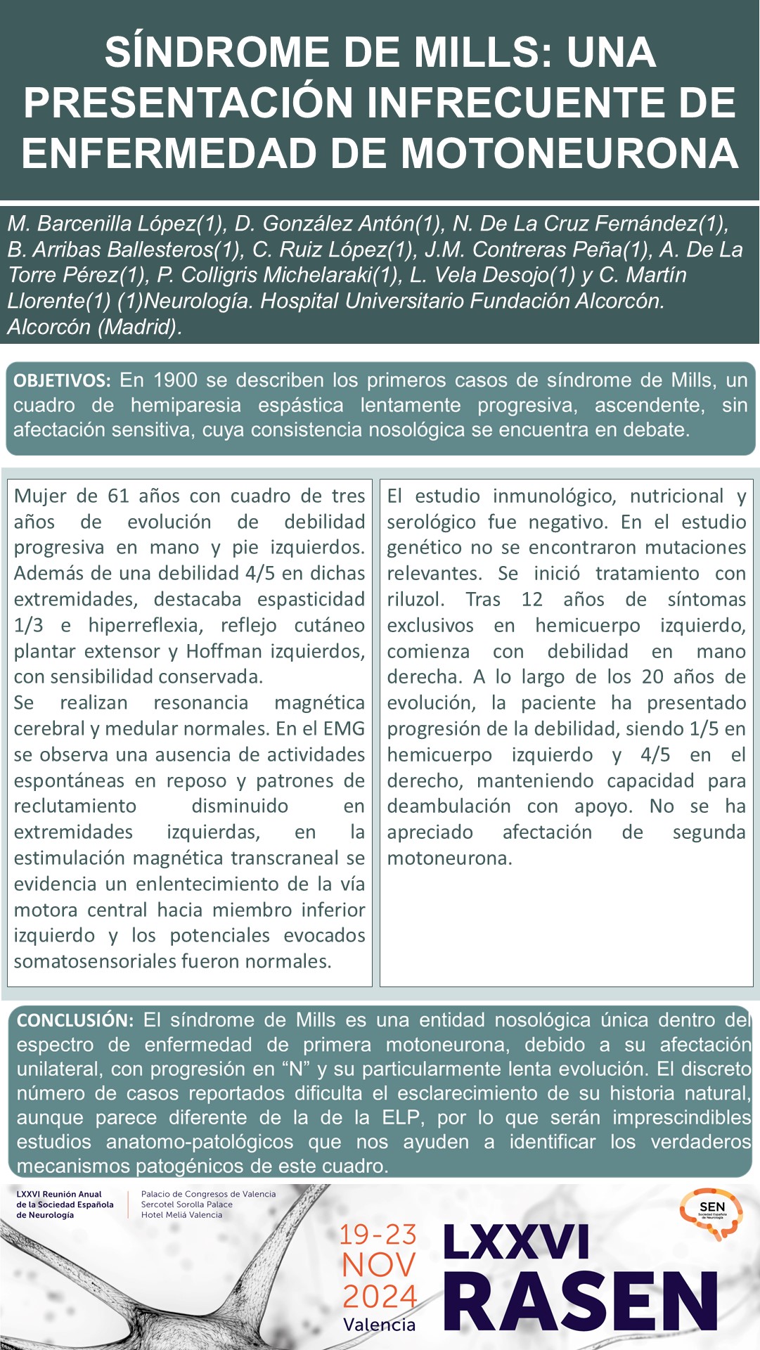 Síndrome de Mills: una presentación infrecuente de enfermedad de motoneurona
