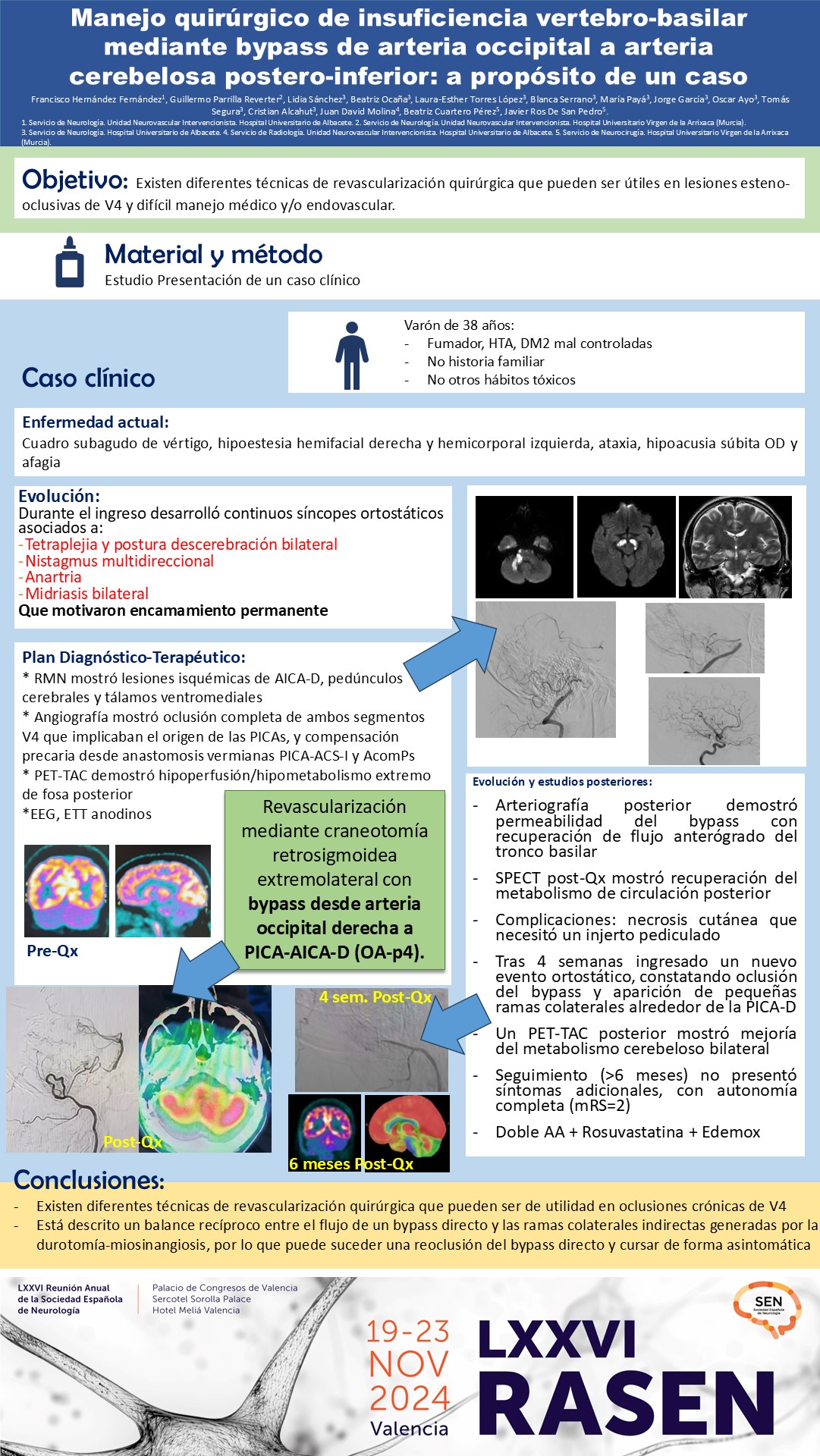 Manejo quirúrgico de insuficiencia vertebro-basilar mediante bypass de arteria occipital a arteria cerebelosa postero-inferior: a propósito de un caso