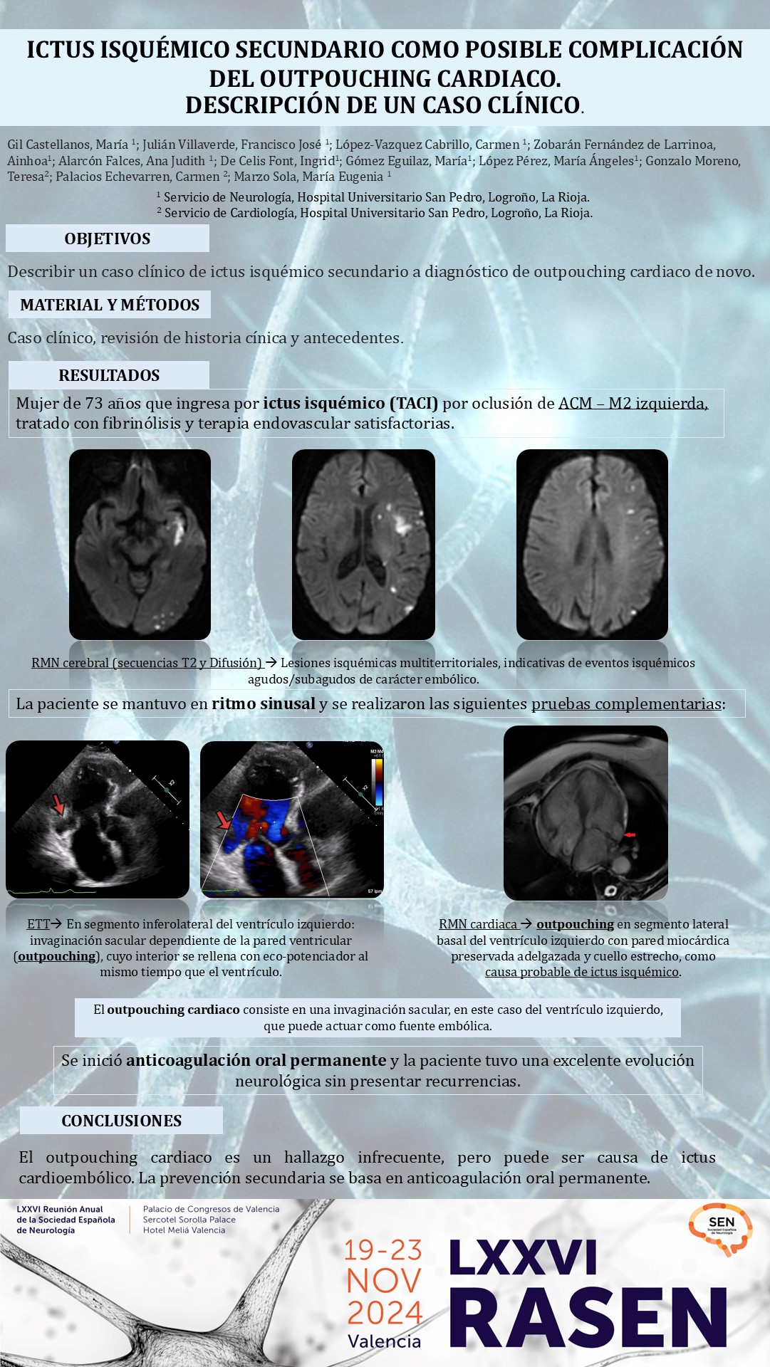 Ictus isquémico secundario como posible complicación del outpouching cardiaco. Descripción de un caso clínico