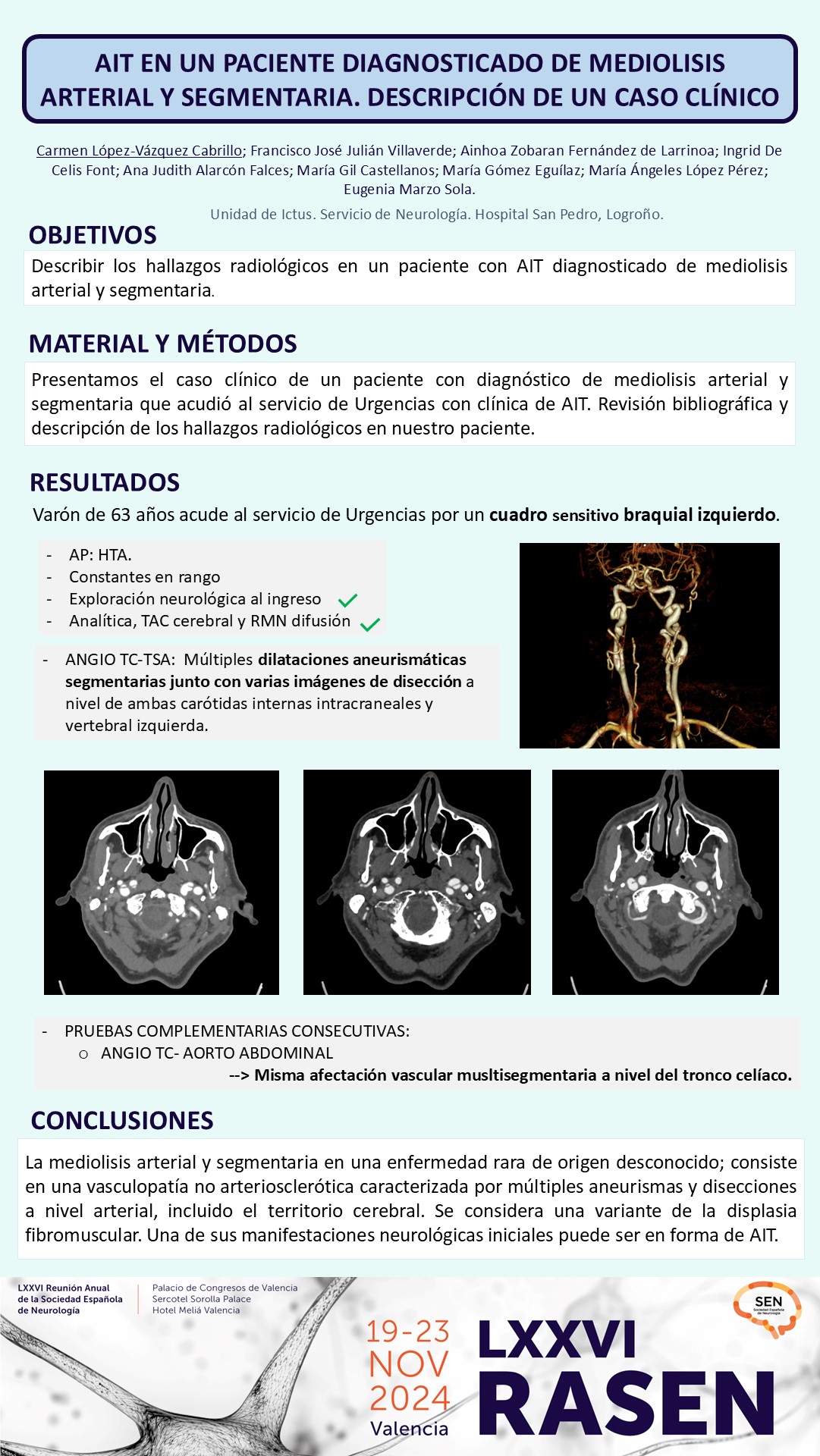 AIT en un paciente diagnosticado de mediolisis arterial y segmentaria. Descripción de un caso clínico
