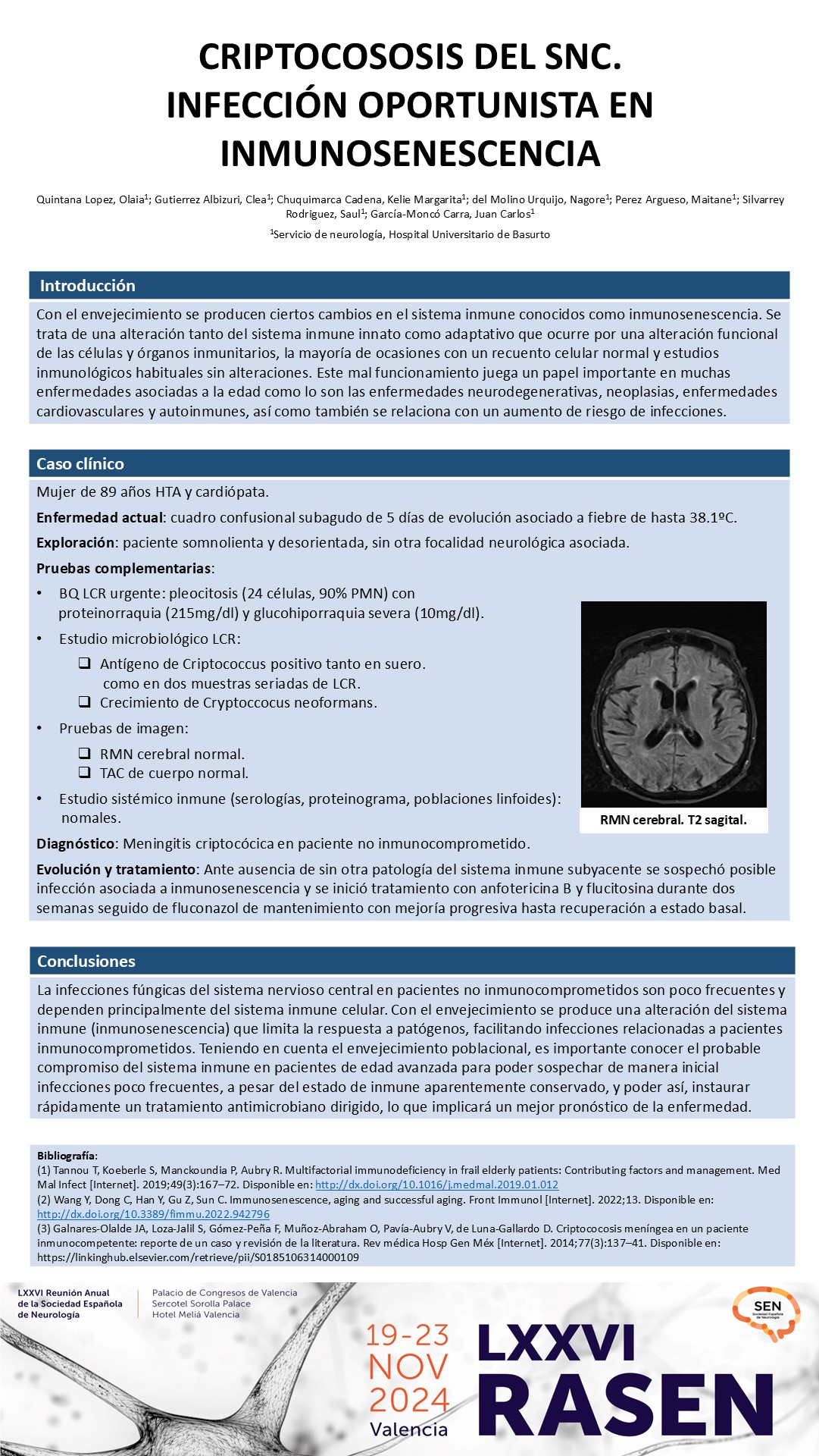 Criptocososis del SNC, infección oportunista en inmunosenescencia