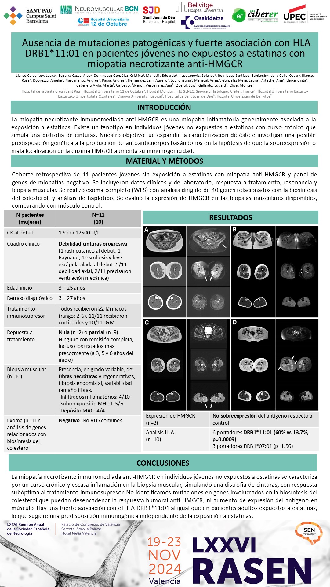 Ausencia de mutaciones patogénicas y fuerte asociación con HLA-DRB1*11:01 en pacientes jóvenes no expuestos a estatinas con miopatía necrotizante anti-HMGCR 