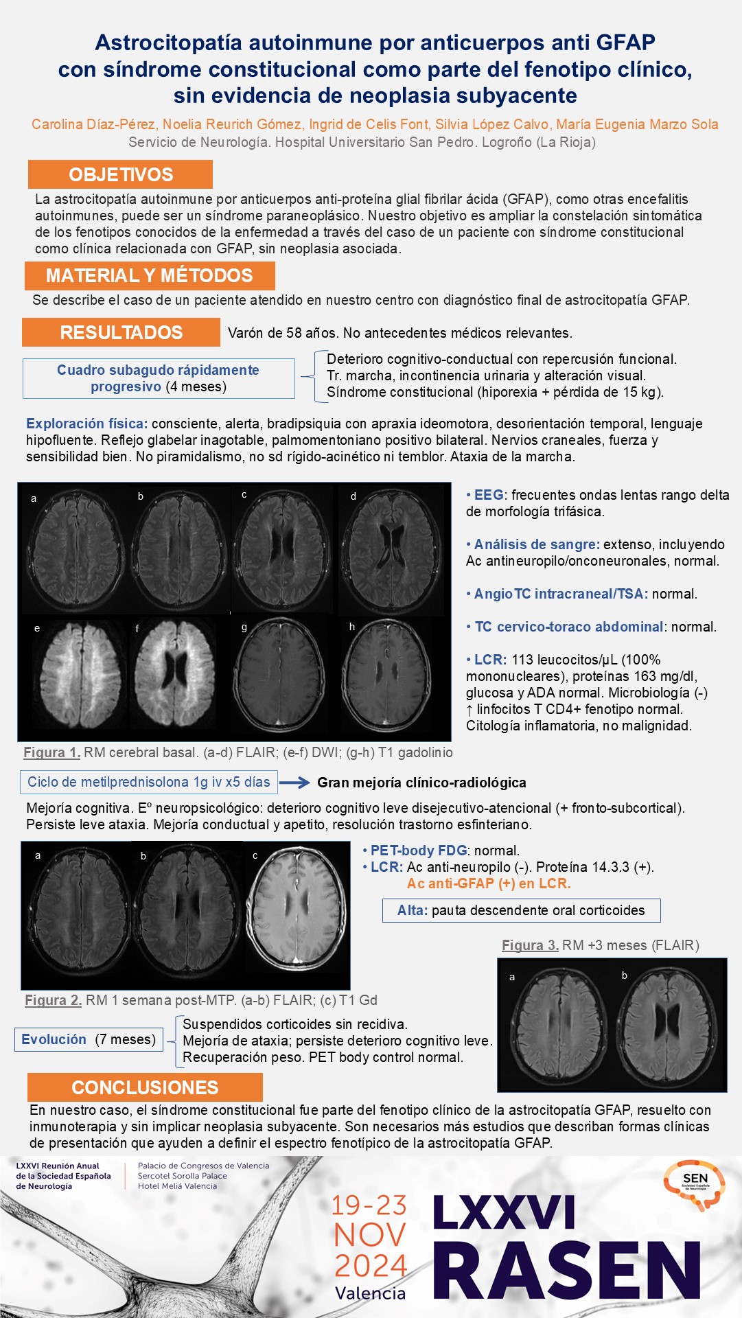 Astrocitopatía autoinmune por anticuerpos anti GFAP con síndrome constitucional como parte del fenotipo clínico, sin evidencia de neoplasia subyacente